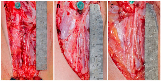 Children 12 00521 g002