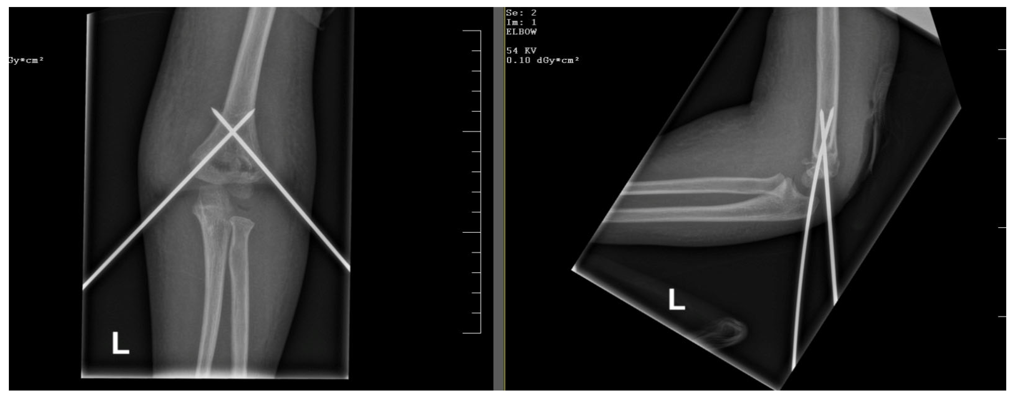 Children 12 00556 g003