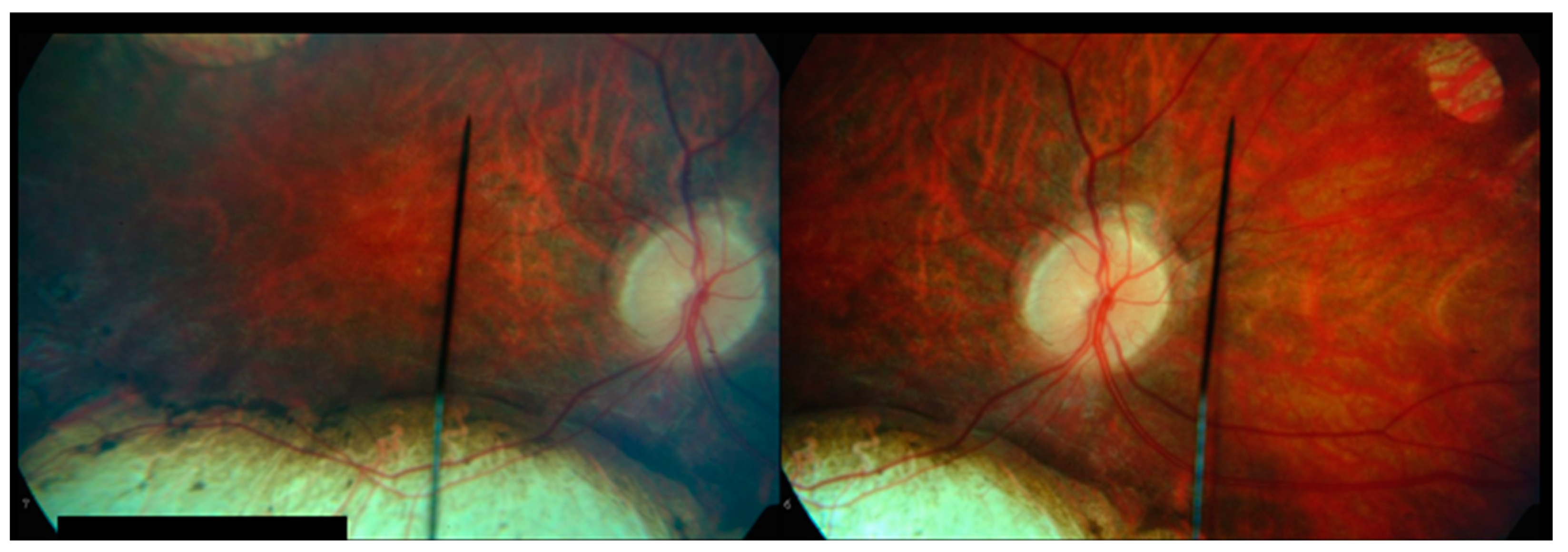 Children 12 00560 g001