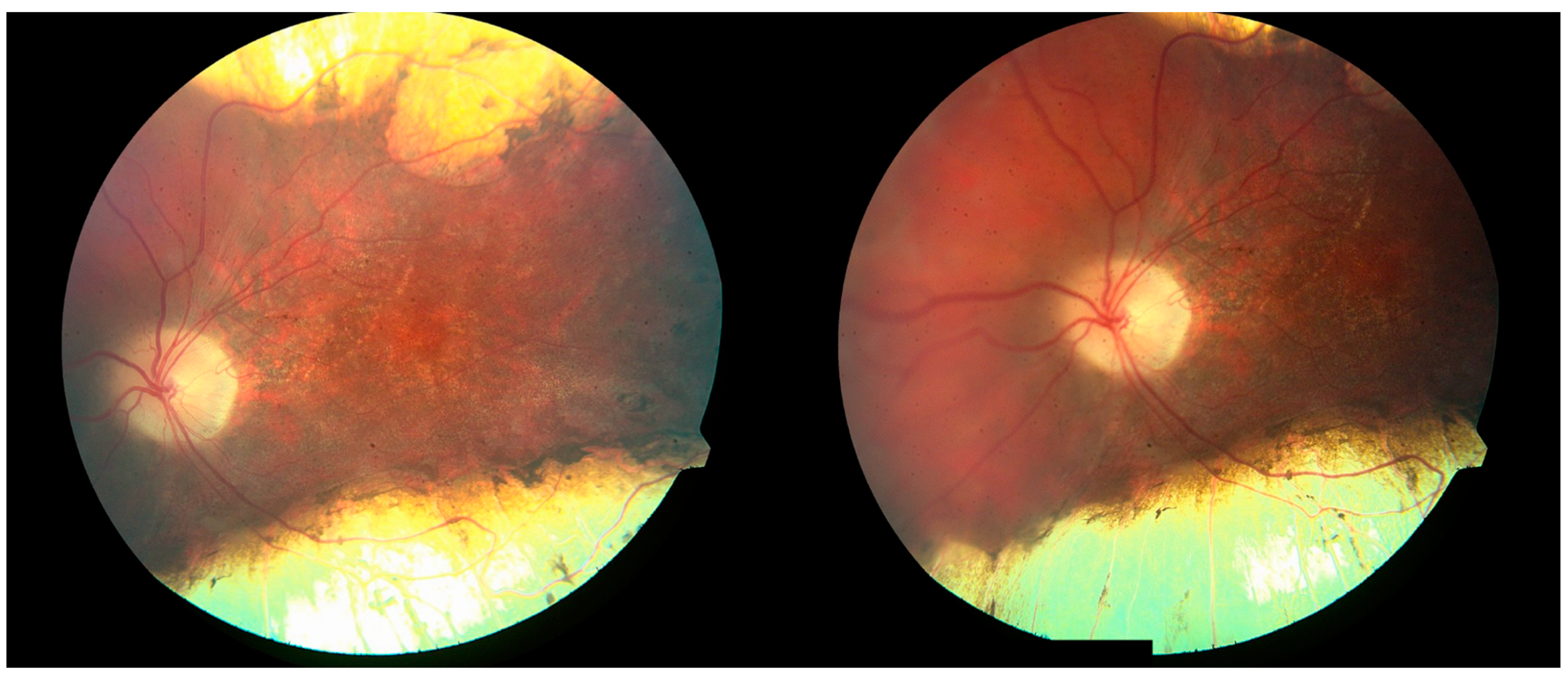 Children 12 00560 g002