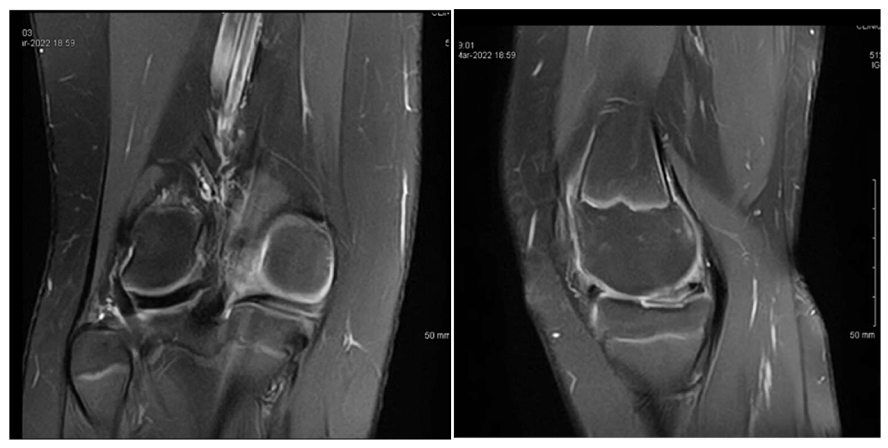 Children 12 00646 g002 Children 12 00646 g002