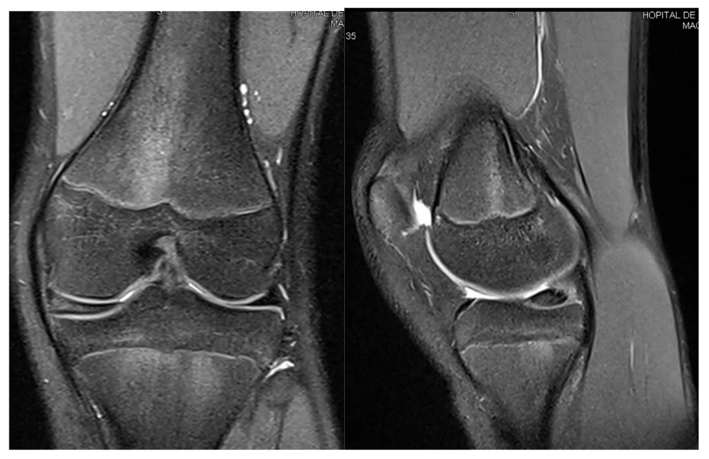 Children 12 00646 g008 Children 12 00646 g008