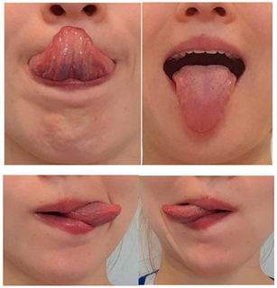 Children 12 00737 i008