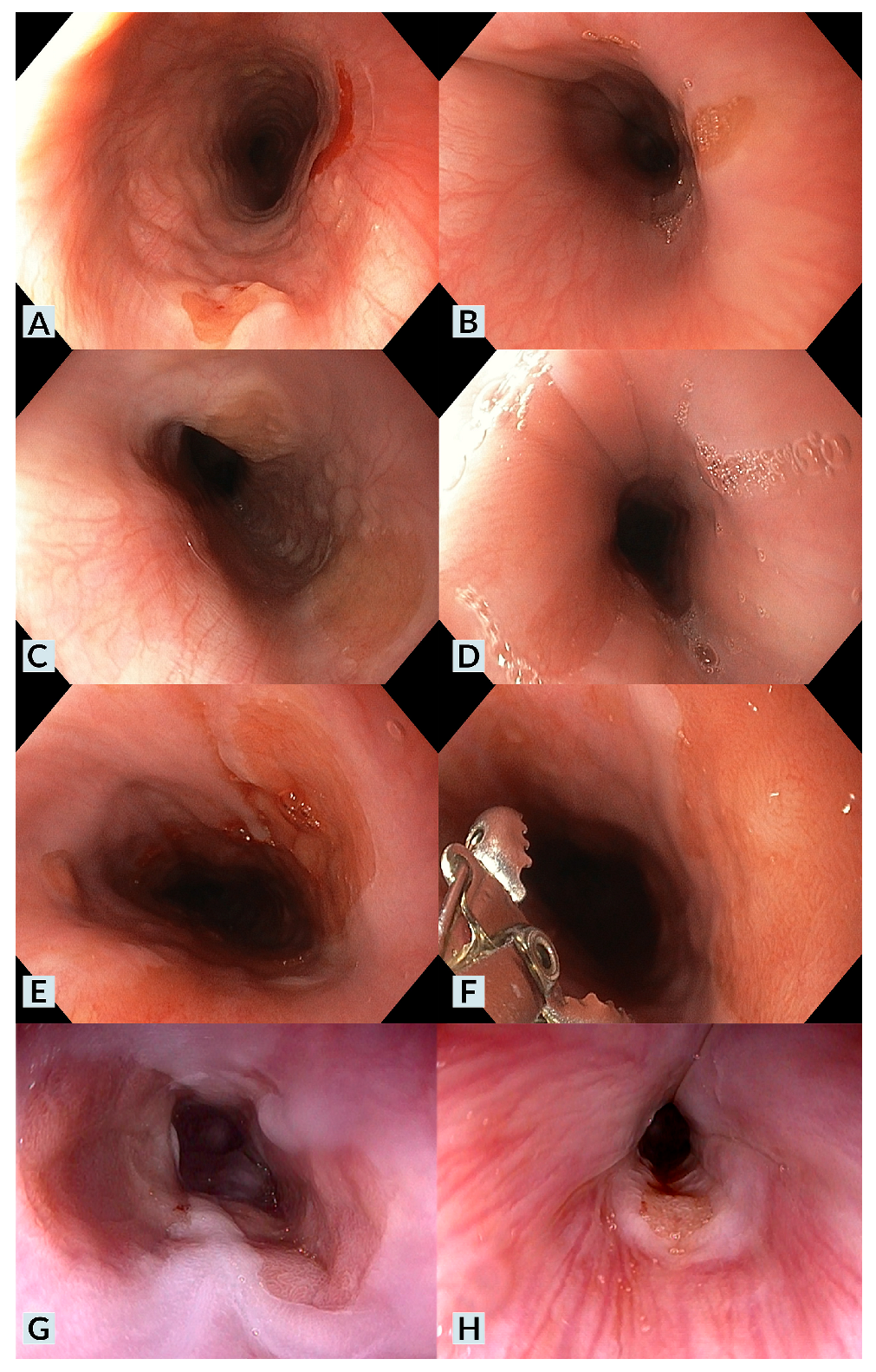 Children 12 00752 g001