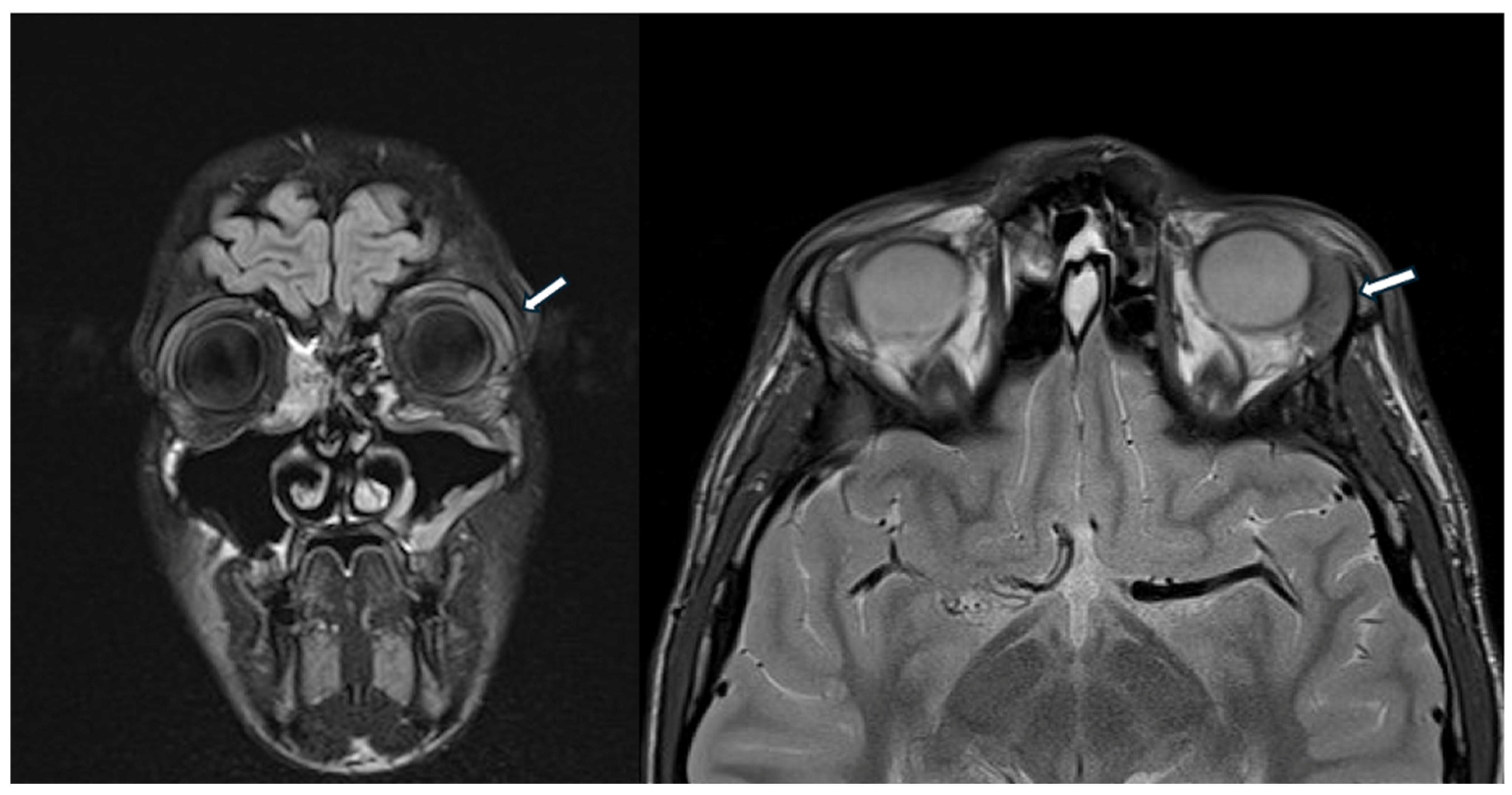 Children 12 00888 g003 Children 12 00888 g003