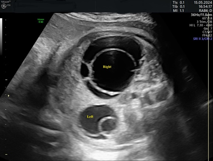 Children 12 00934 g003 Children 12 00934 g003