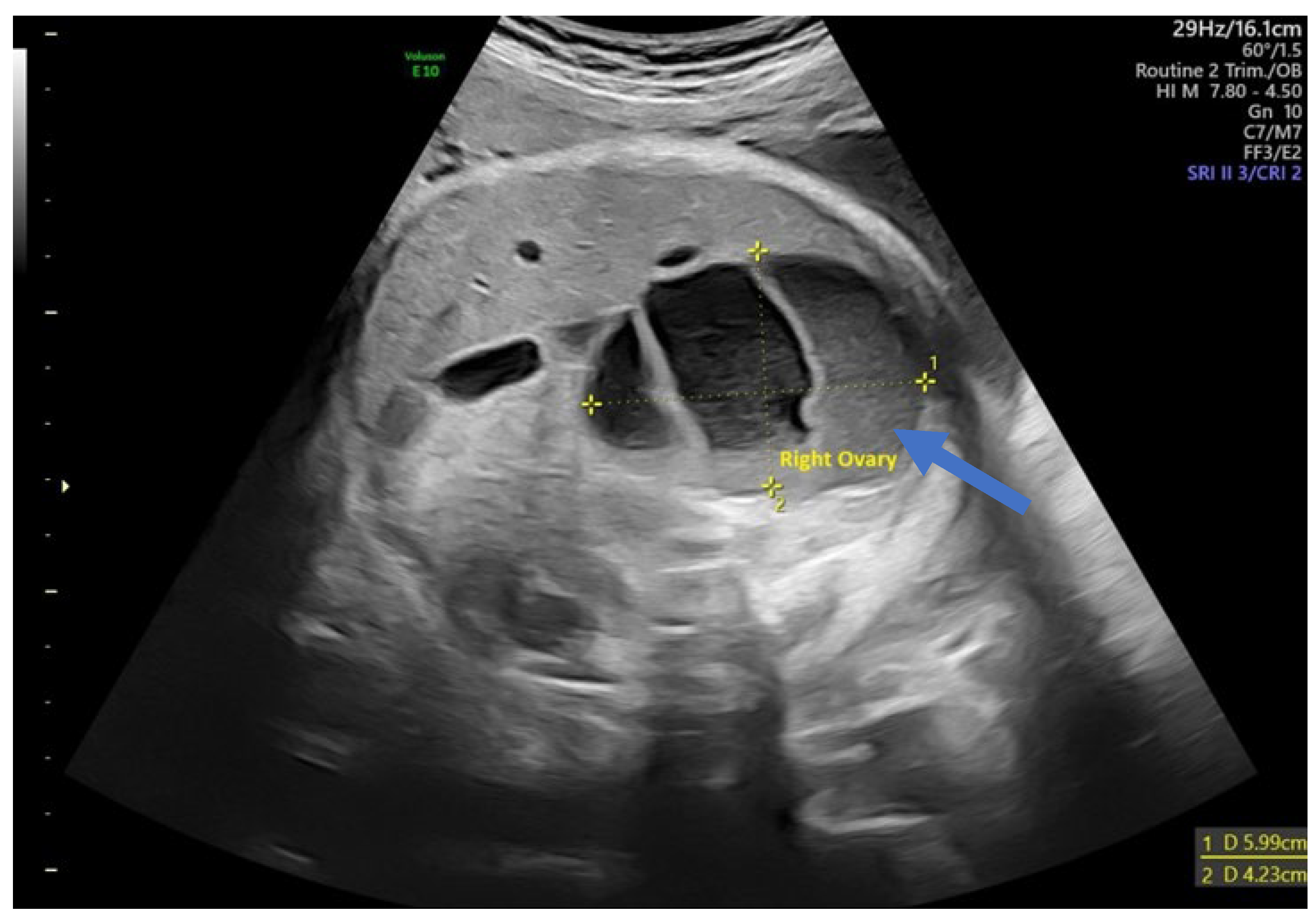 Children 12 00934 g004 Children 12 00934 g004