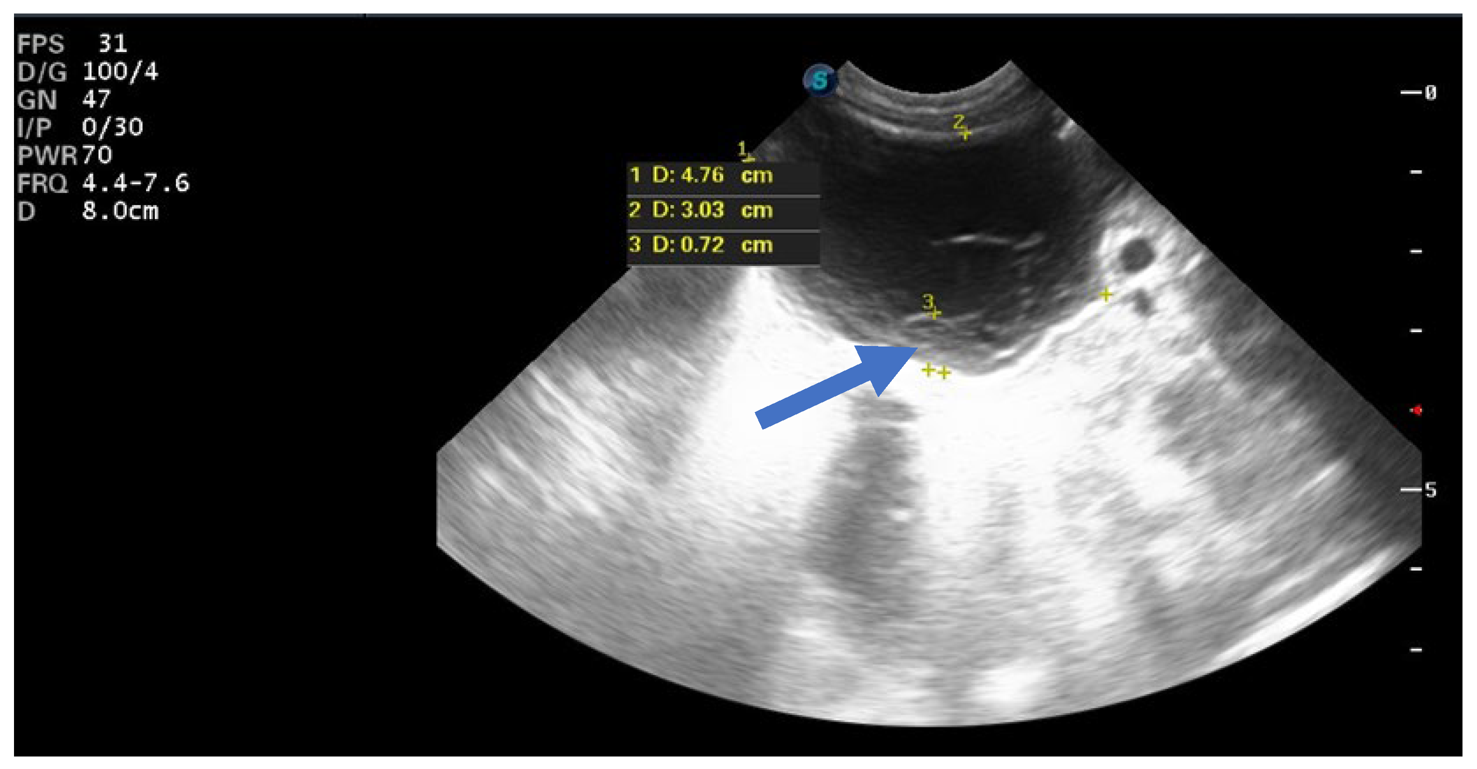 Children 12 00934 g006 Children 12 00934 g006