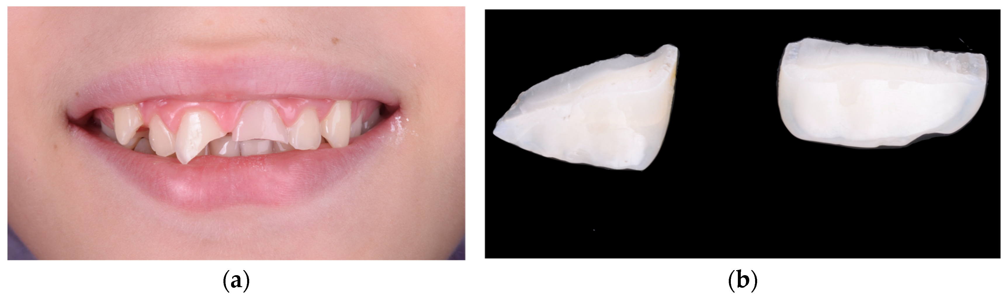 Children 12 01019 g004a Children 12 01019 g004a