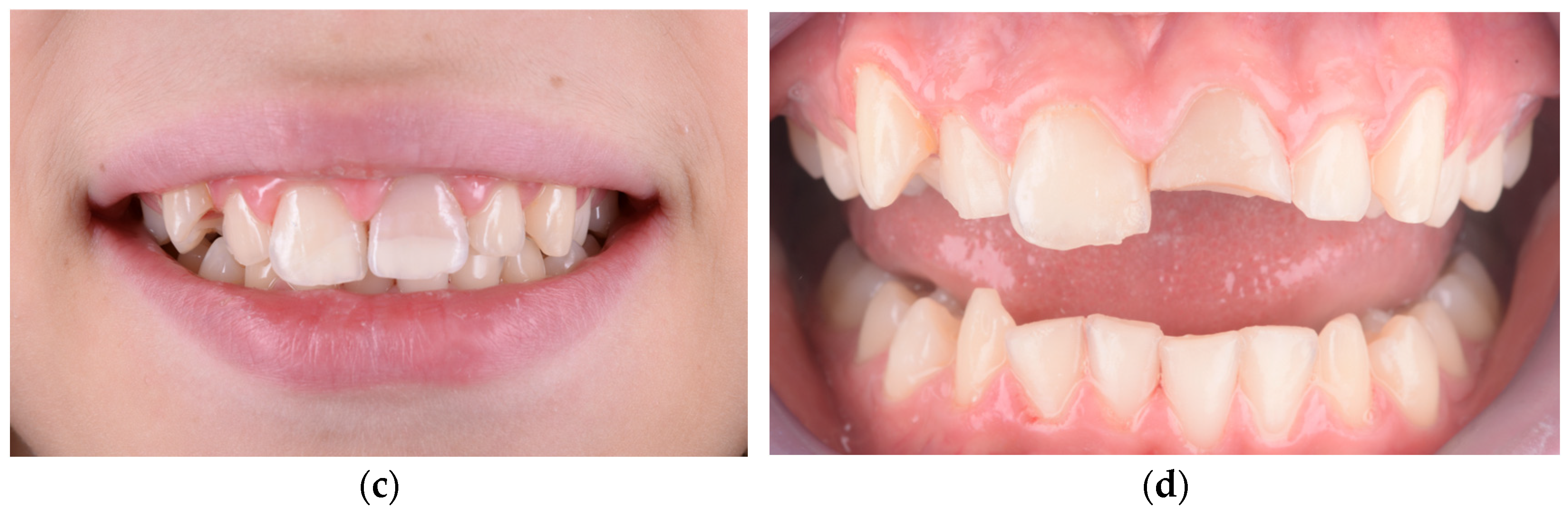 Children 12 01019 g004b Children 12 01019 g004b