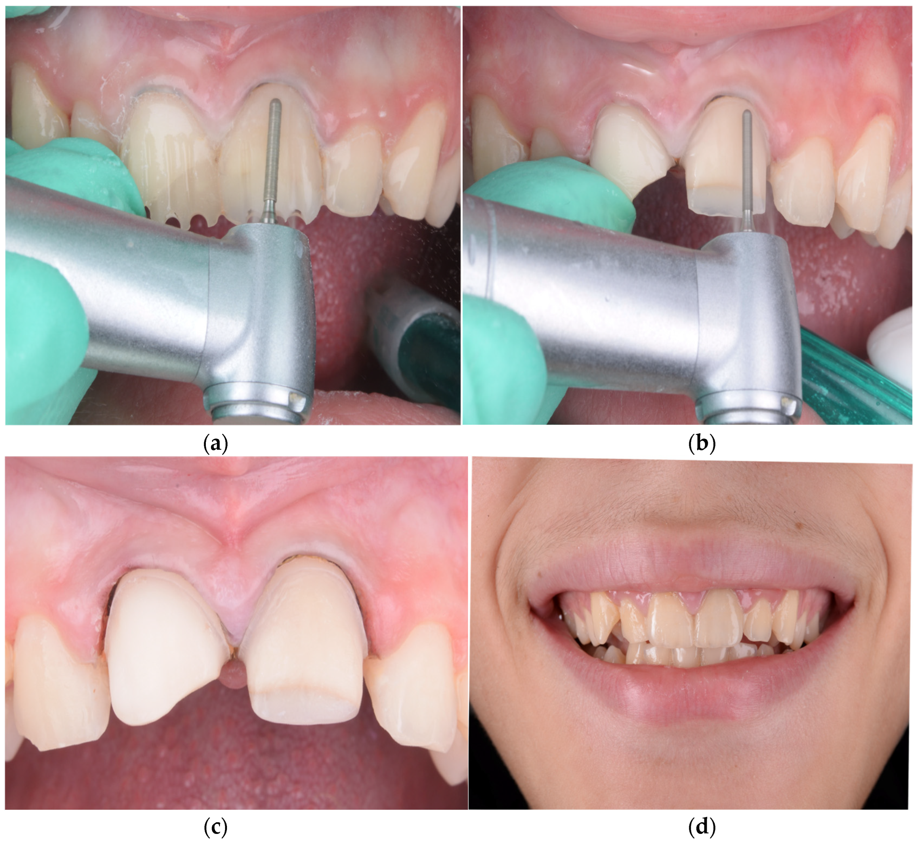 Children 12 01019 g005 Children 12 01019 g005