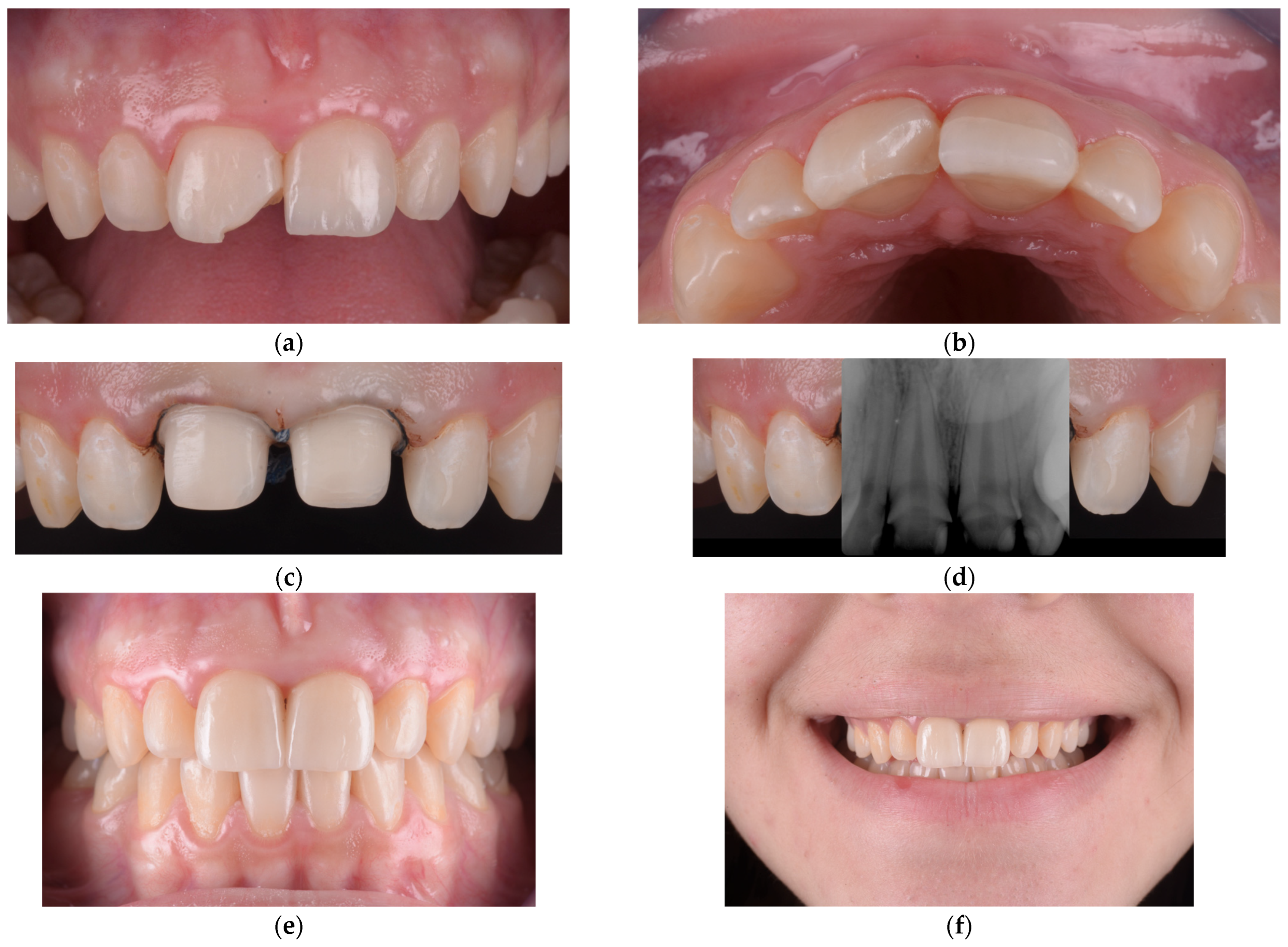 Children 12 01019 g006 Children 12 01019 g006