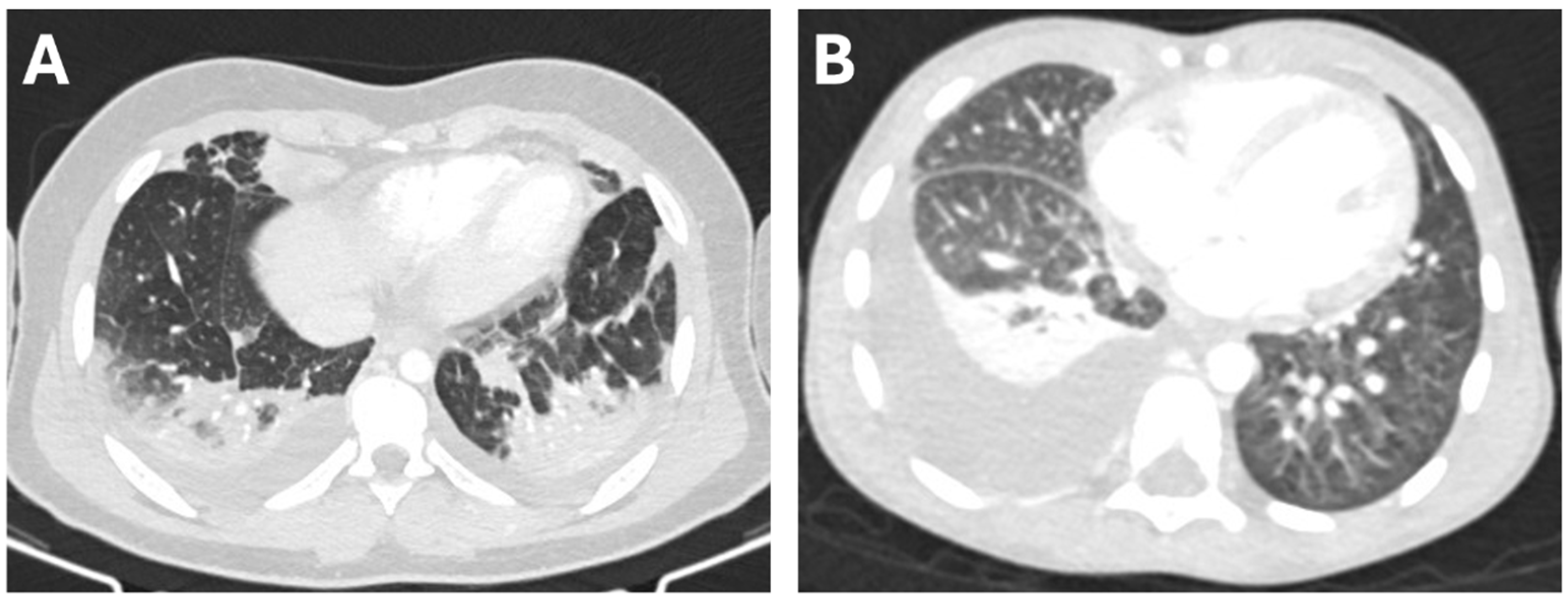 Children 12 01103 g001