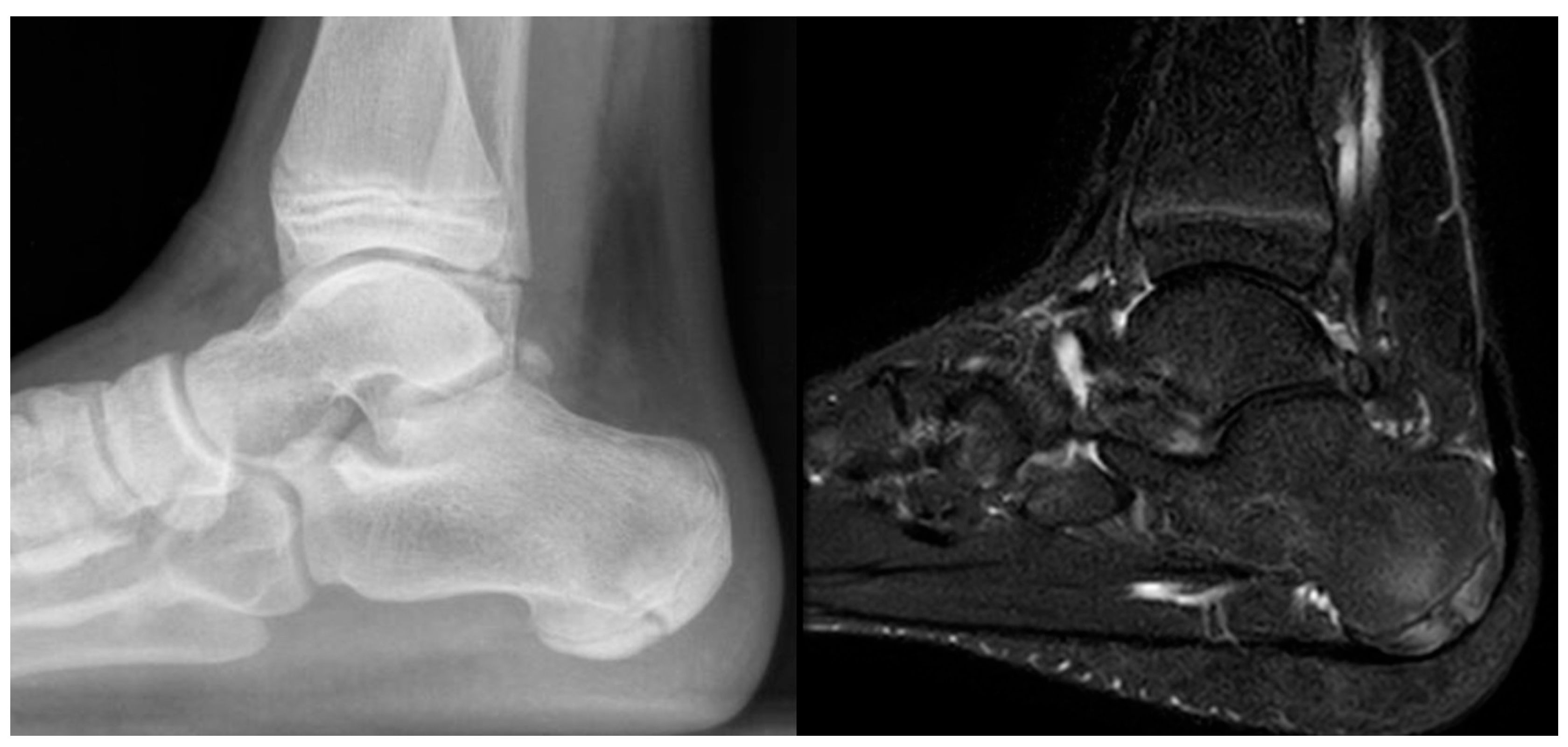 Children 12 01114 g003