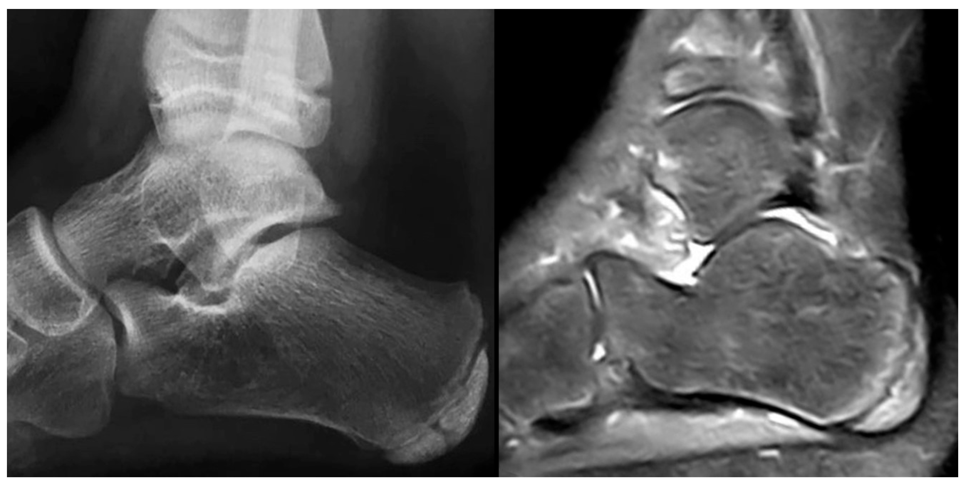 Children 12 01114 g004