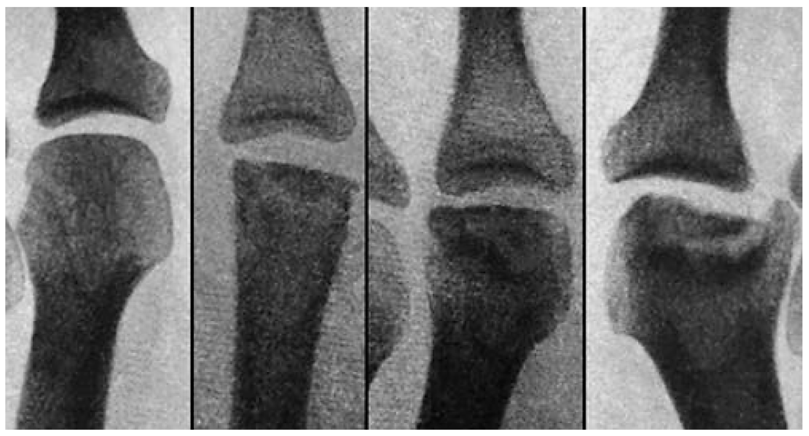 Children 12 01114 g013