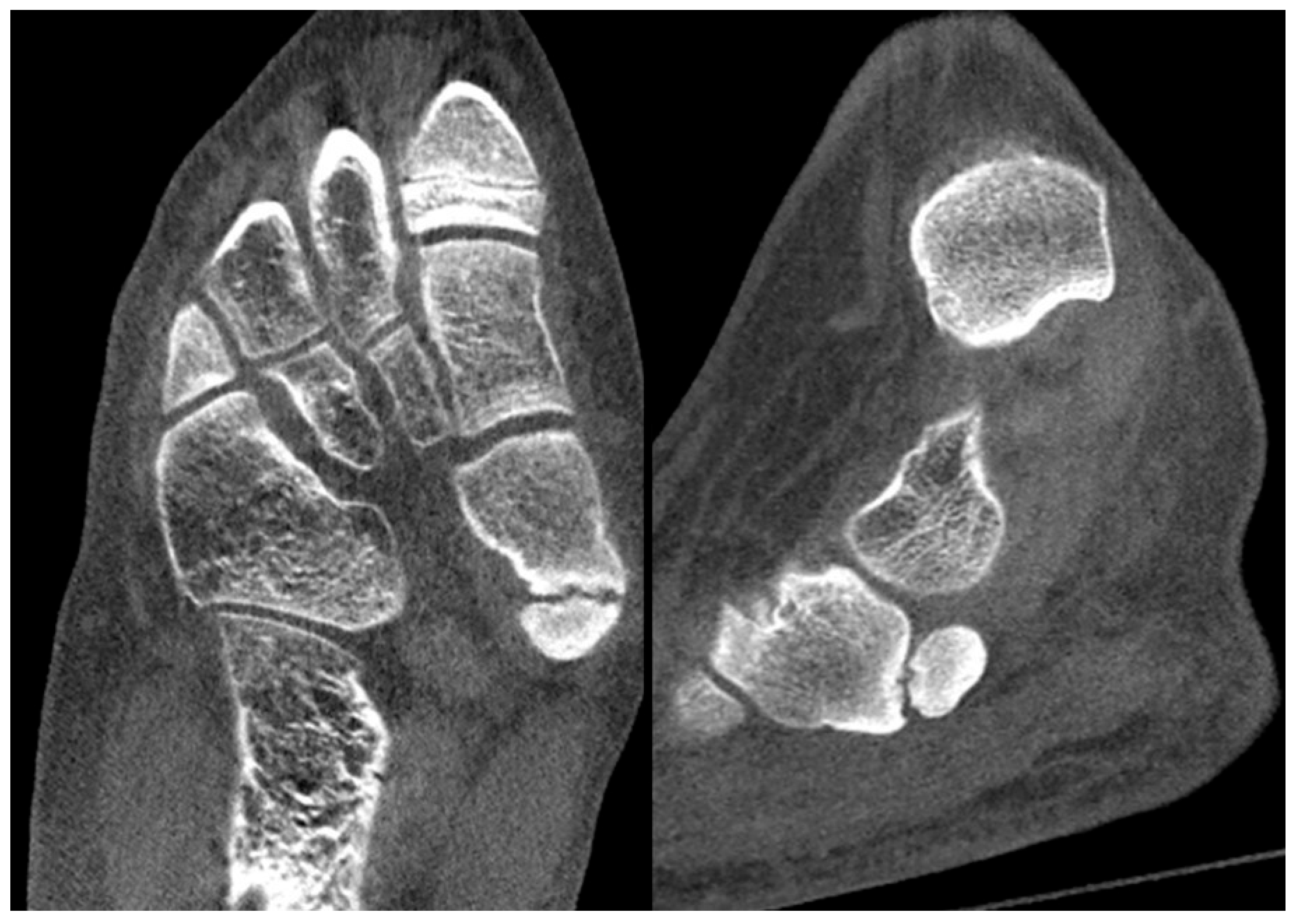 Children 12 01114 g017