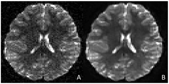 Children 12 01127 g001