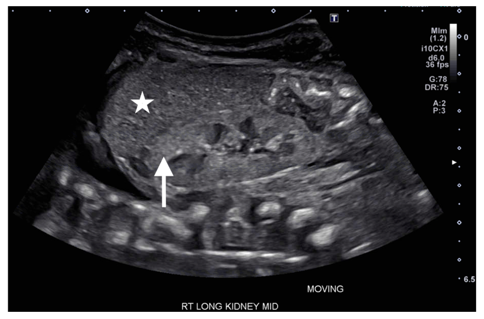 Children 12 01179 g001