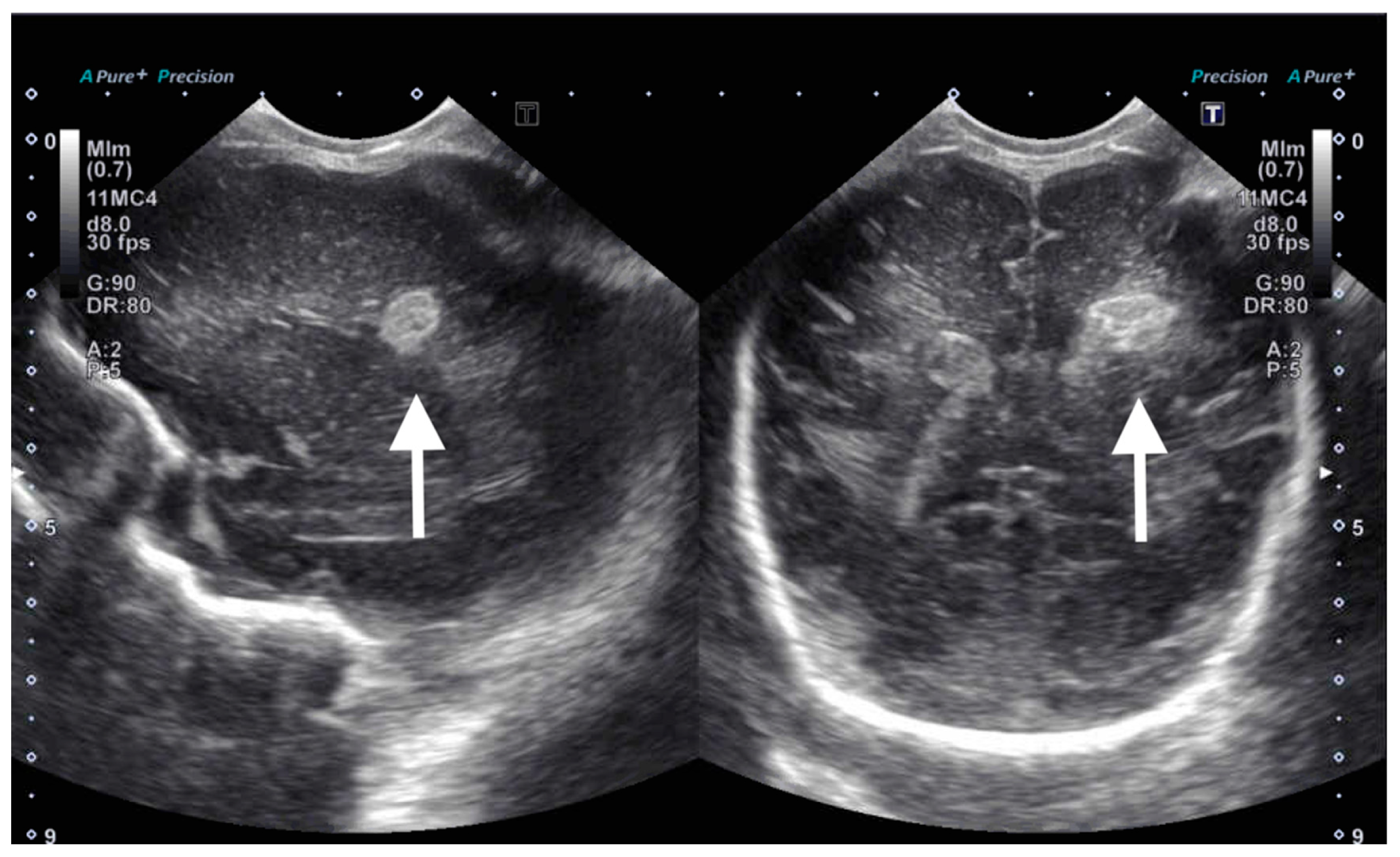 Children 12 01179 g004