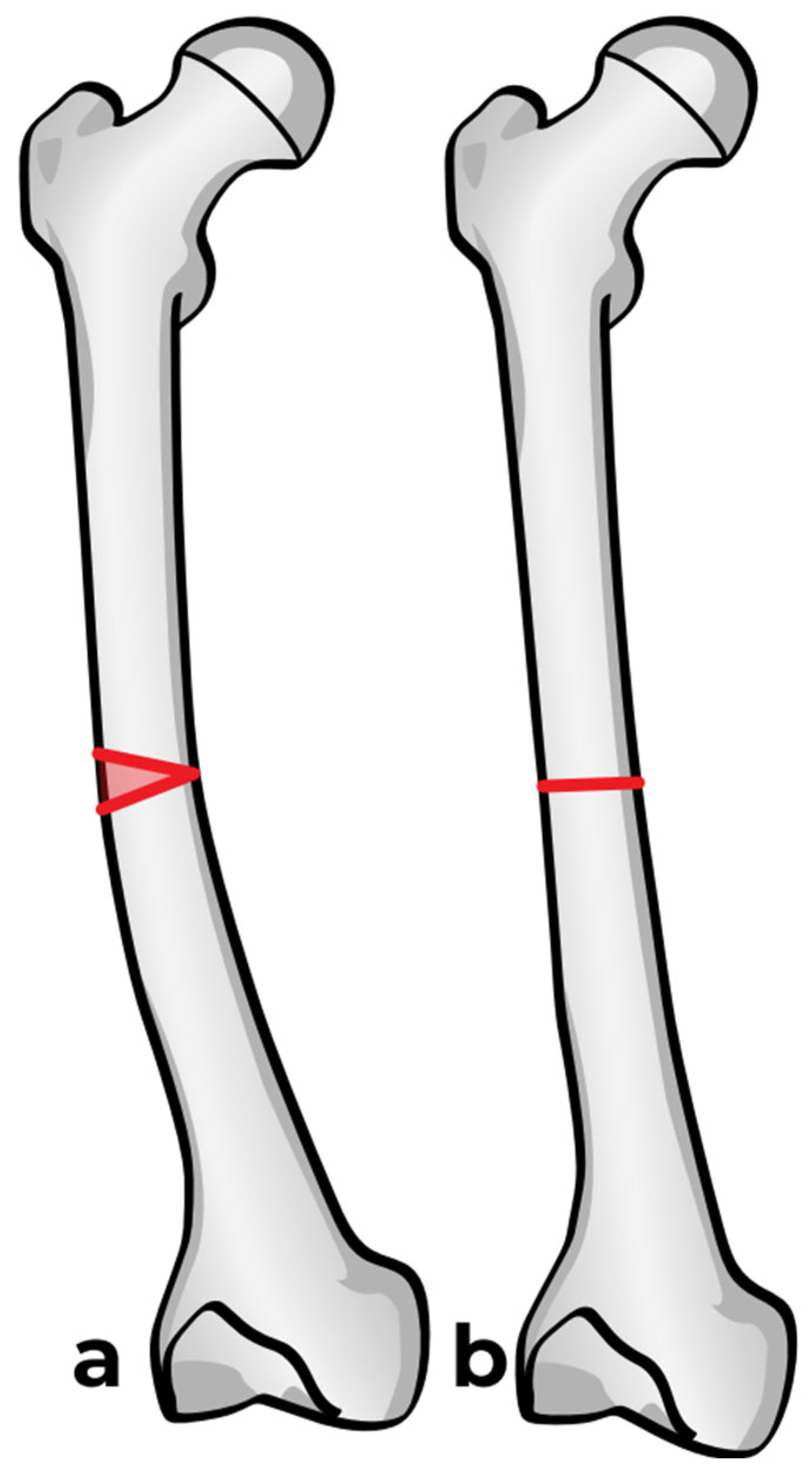 Children 12 01190 g006a Children 12 01190 g006a