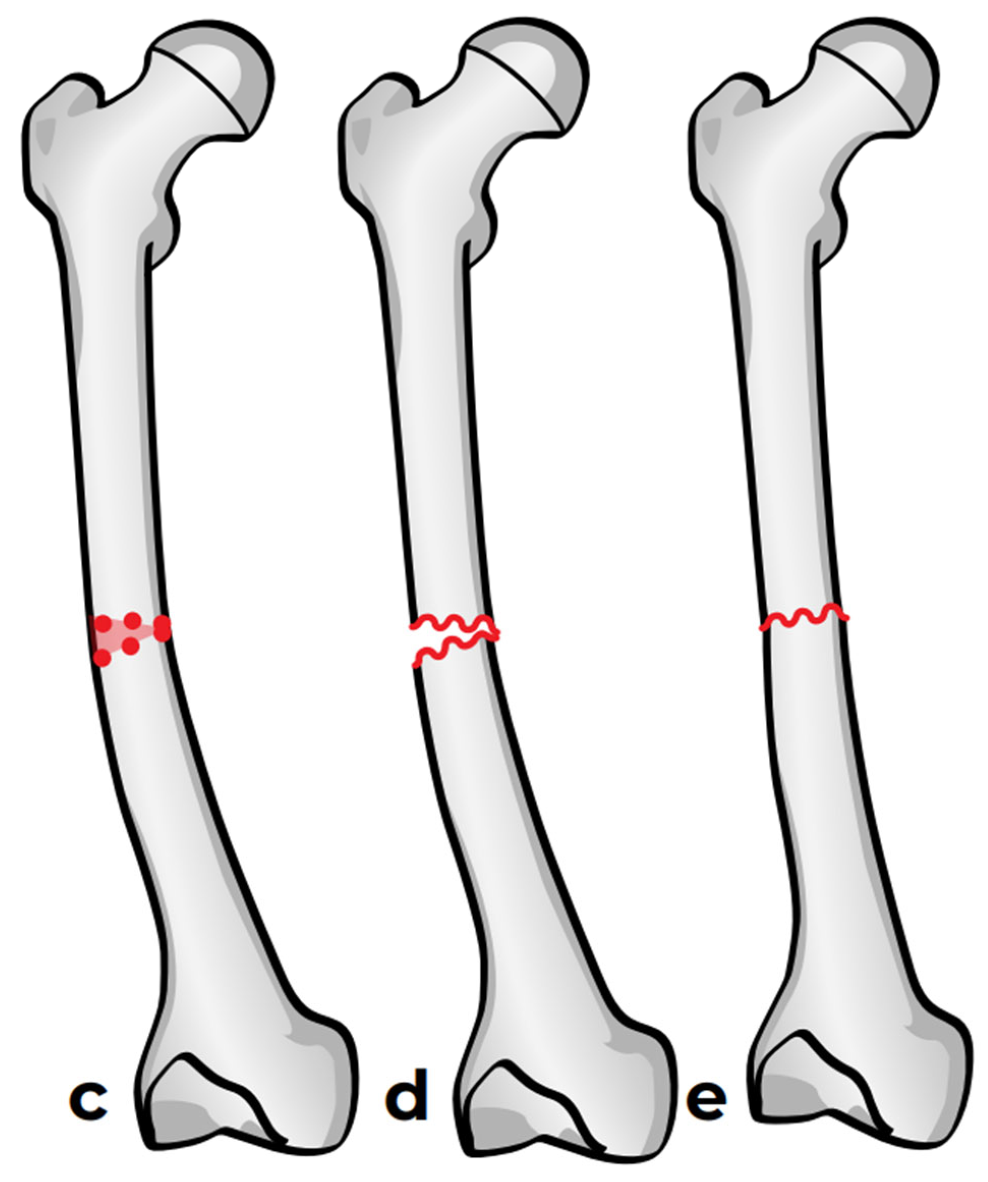 Children 12 01190 g006b Children 12 01190 g006b