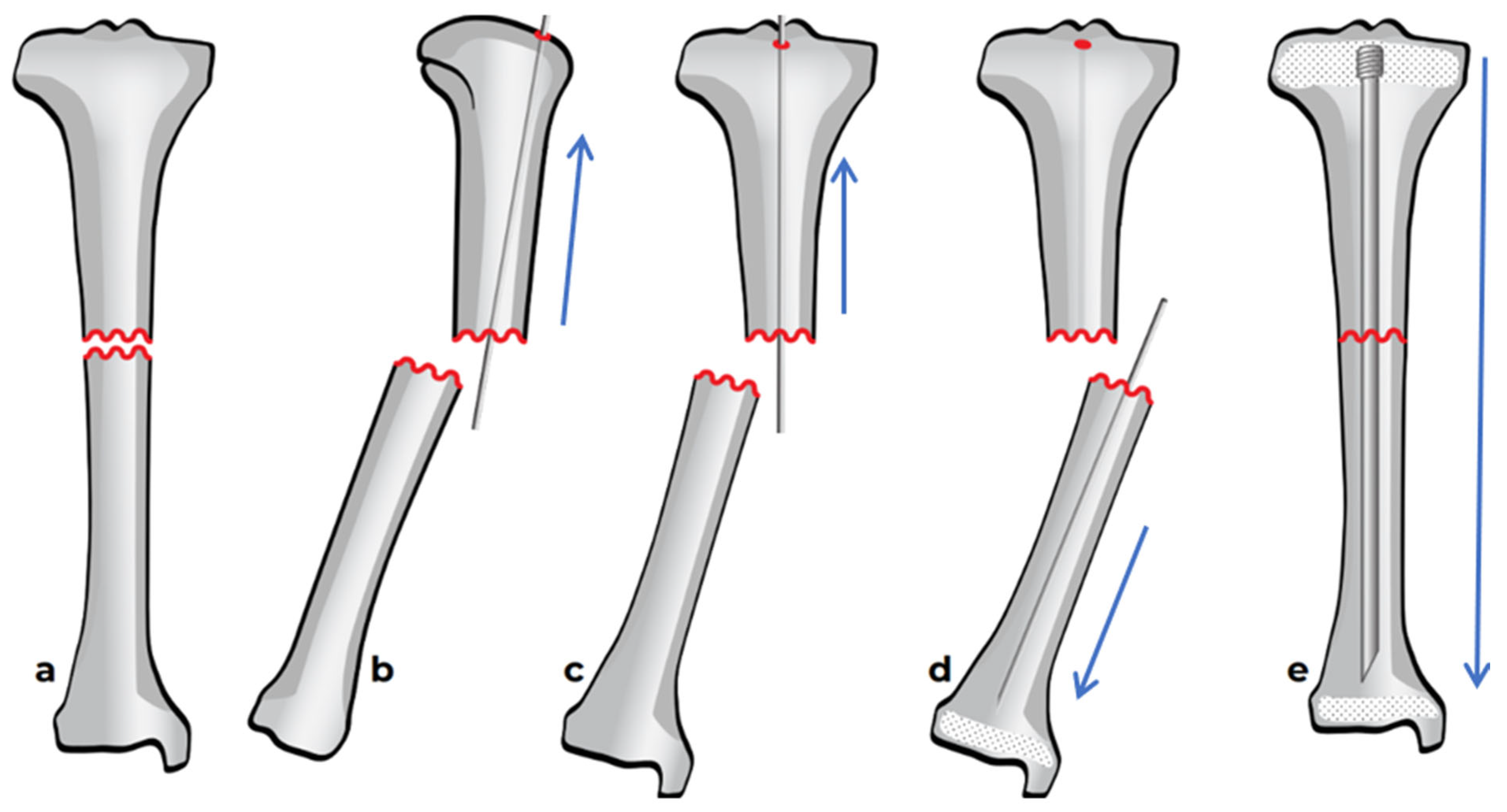 Children 12 01190 g007 Children 12 01190 g007