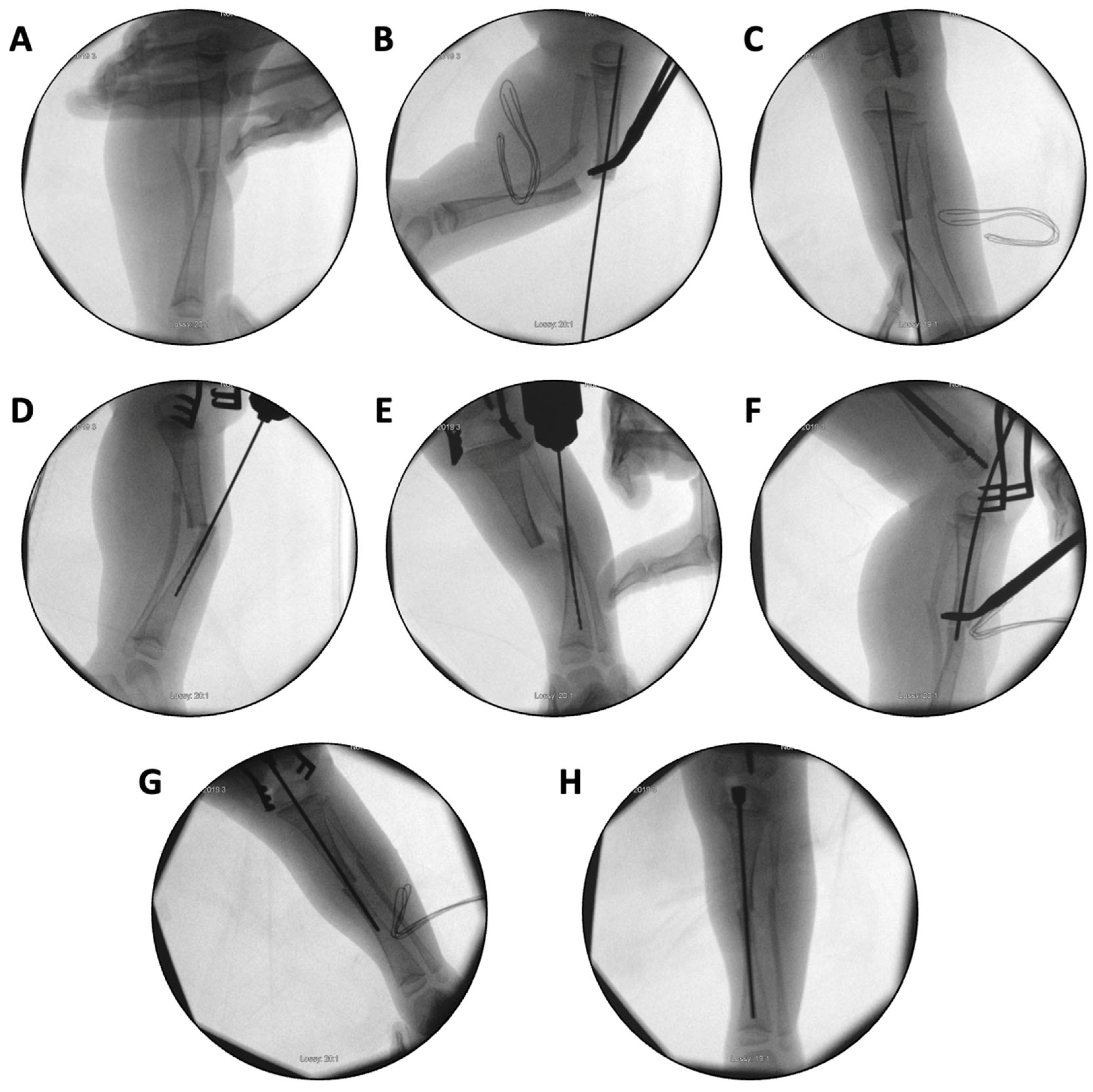Children 12 01190 g009 Children 12 01190 g009
