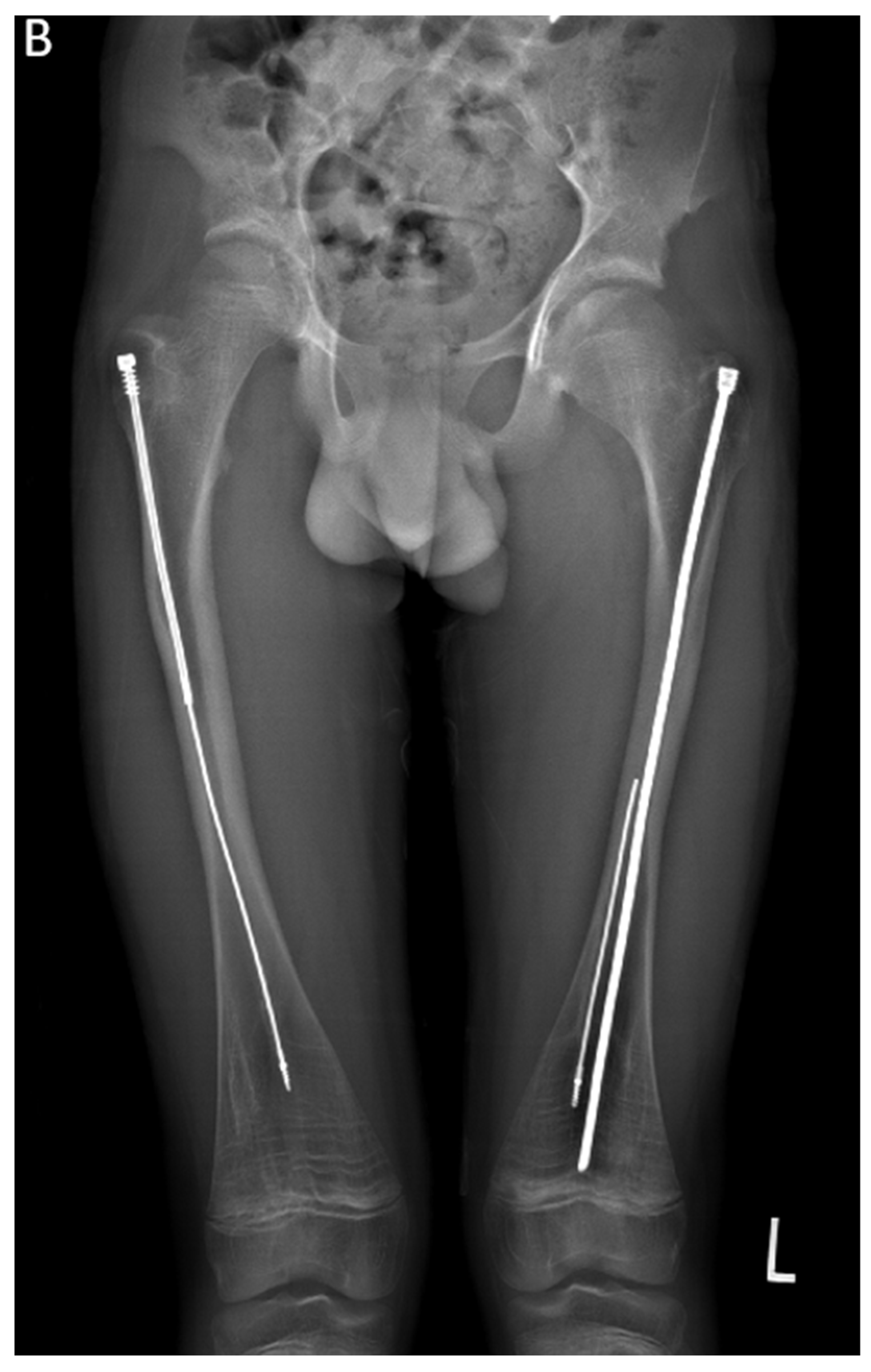 Children 12 01190 g010b Children 12 01190 g010b