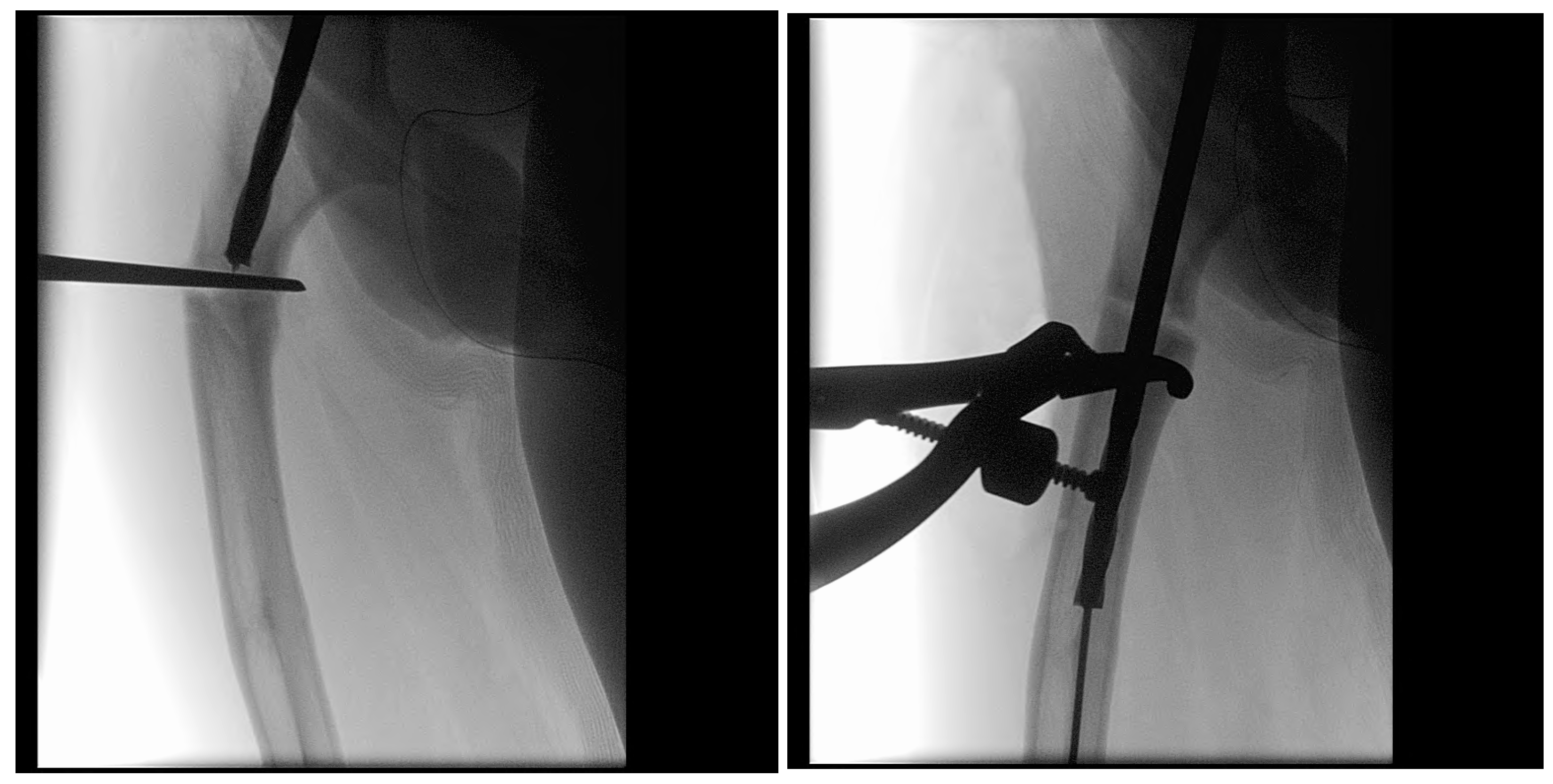 Children 12 01190 g012 Children 12 01190 g012