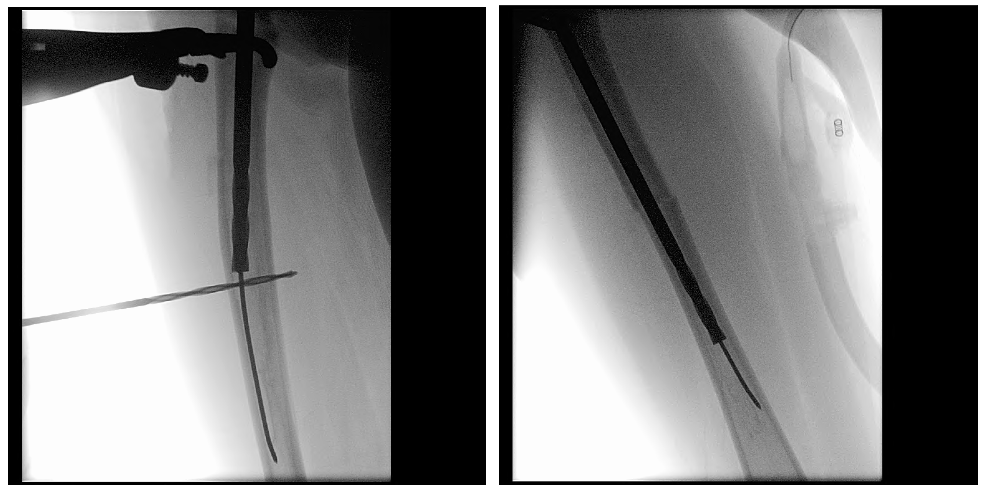 Children 12 01190 g013 Children 12 01190 g013