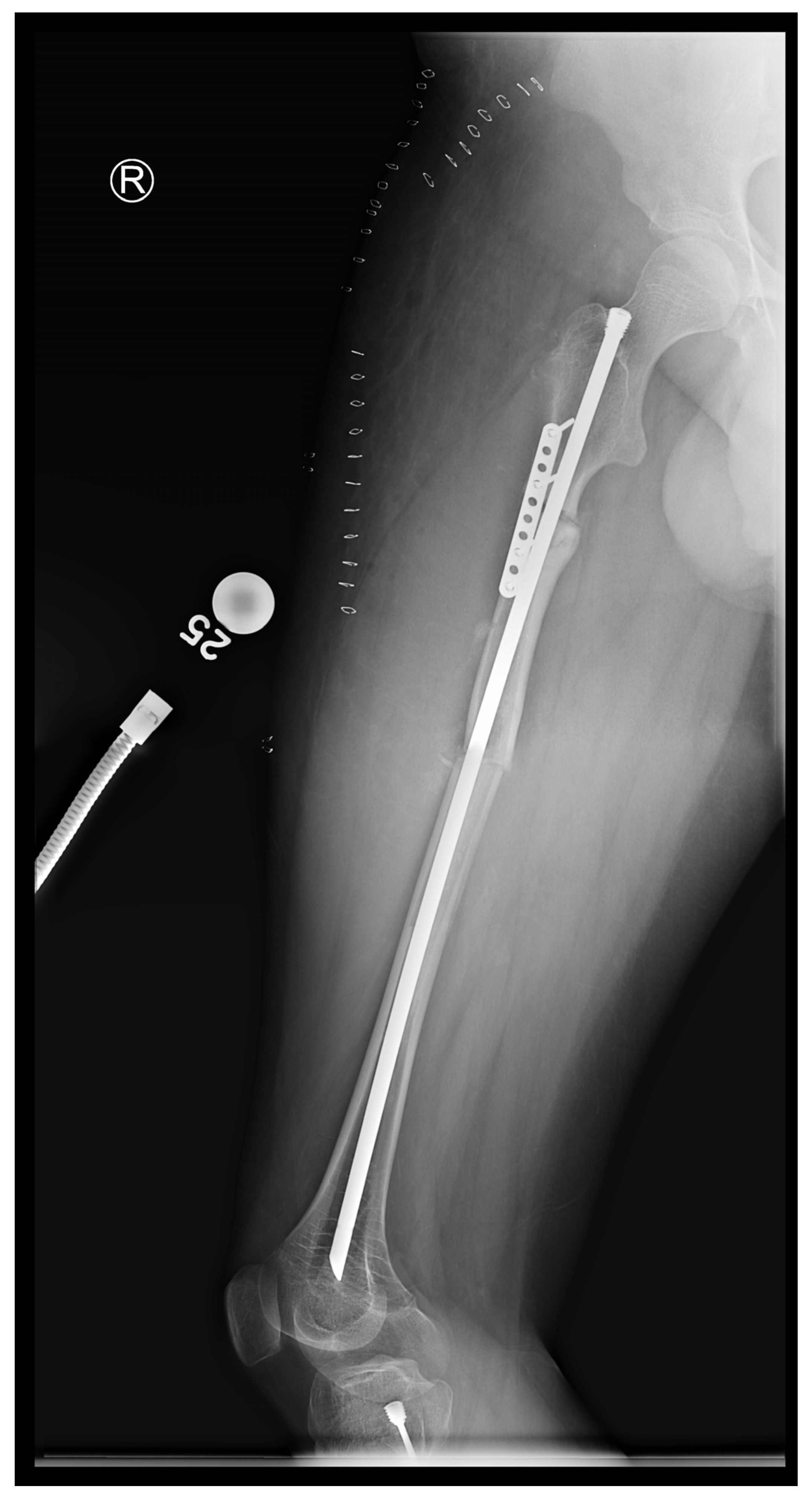 Children 12 01190 g014 Children 12 01190 g014