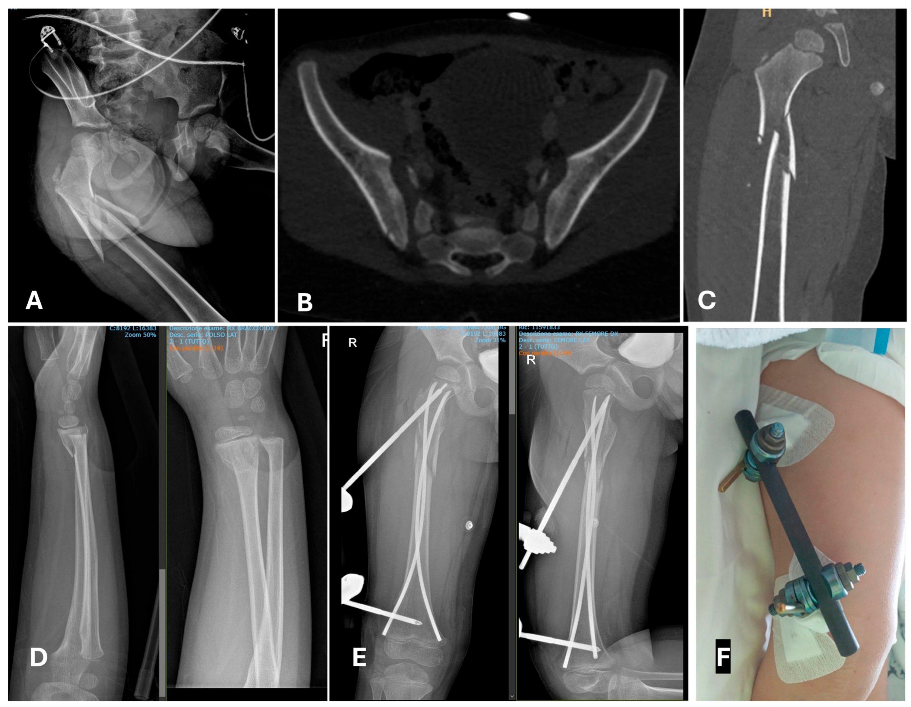 Children 12 01194 g006