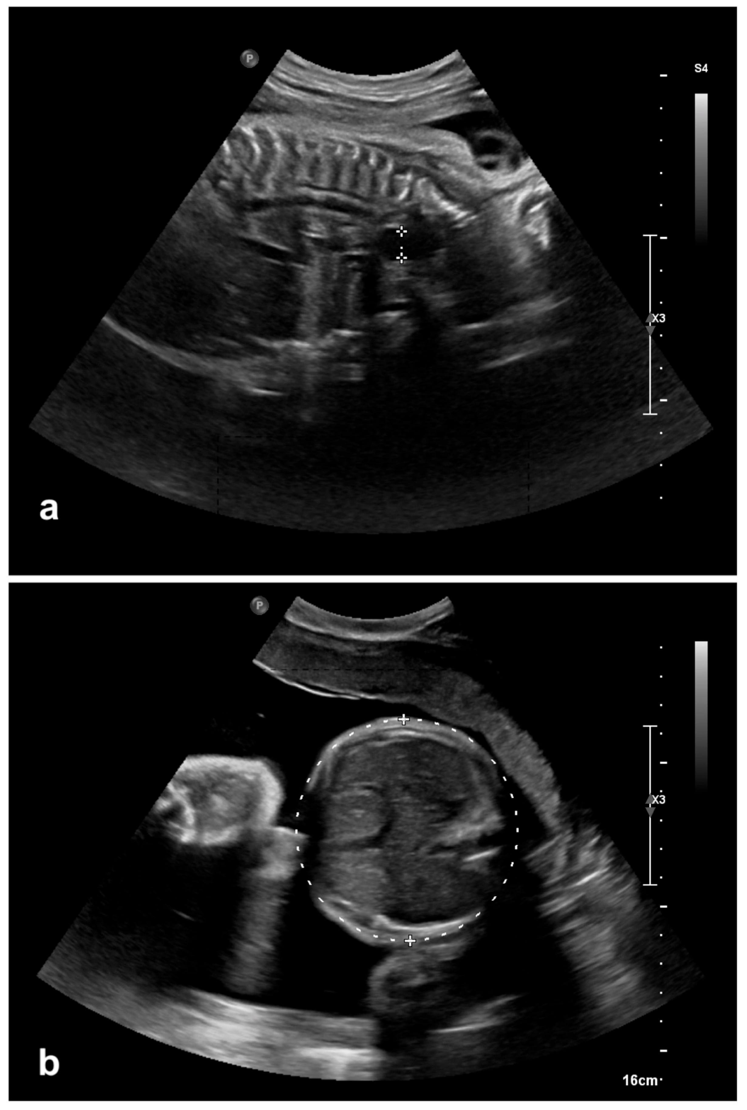 Children 12 01244 g001 Children 12 01244 g001