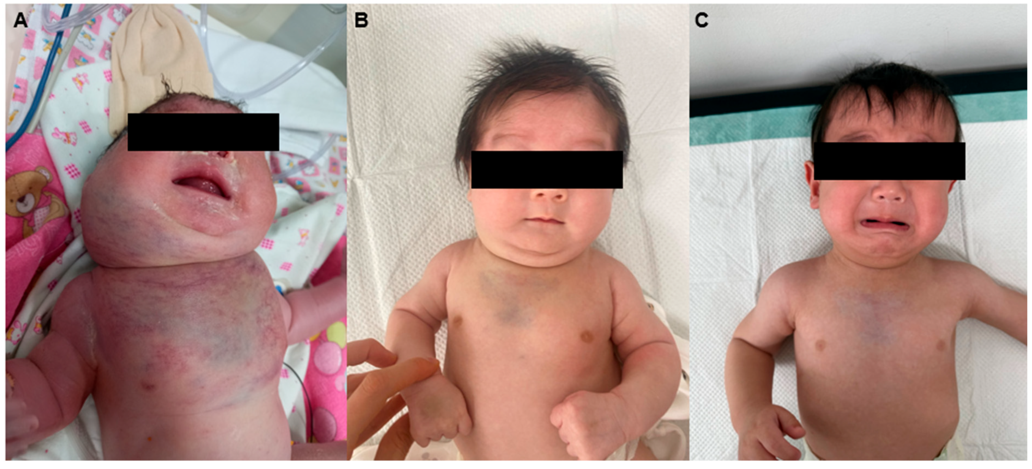 Children 12 01429 g001