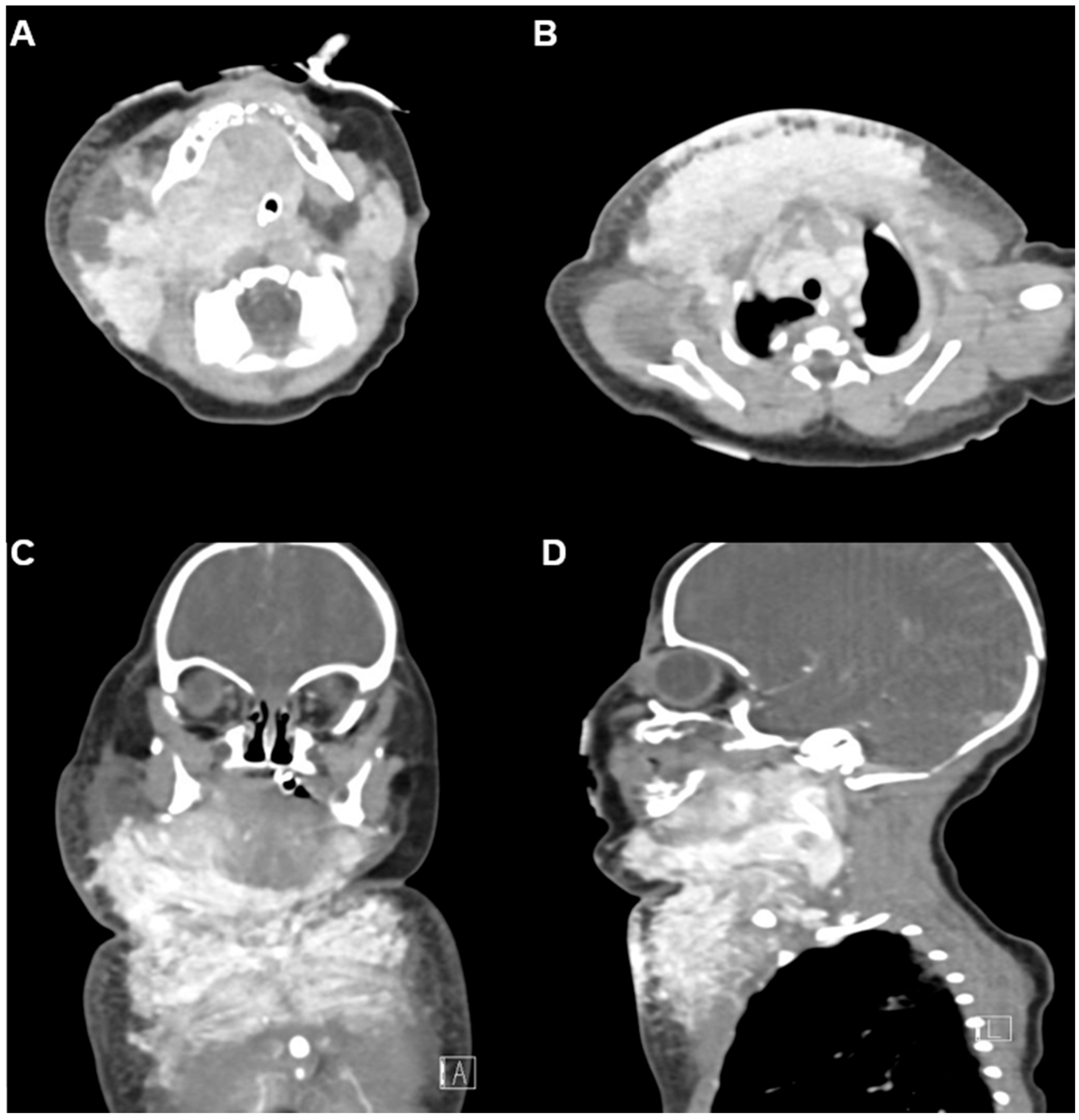 Children 12 01429 g002