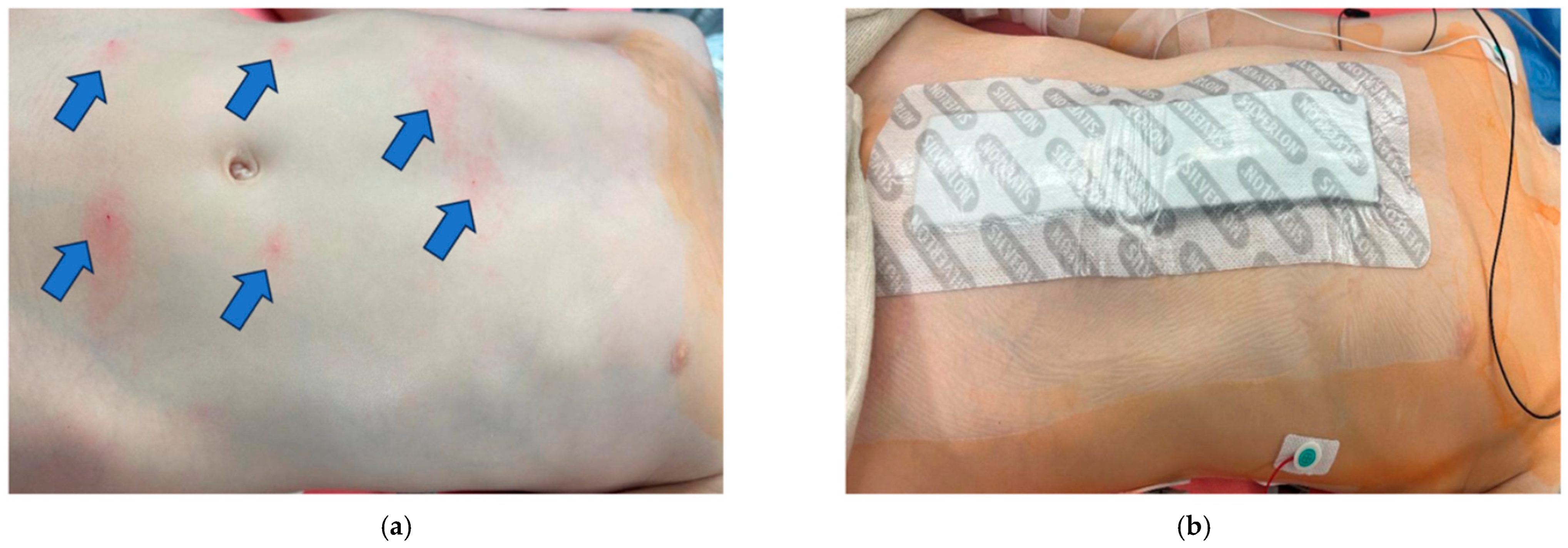 Children 12 01450 g002