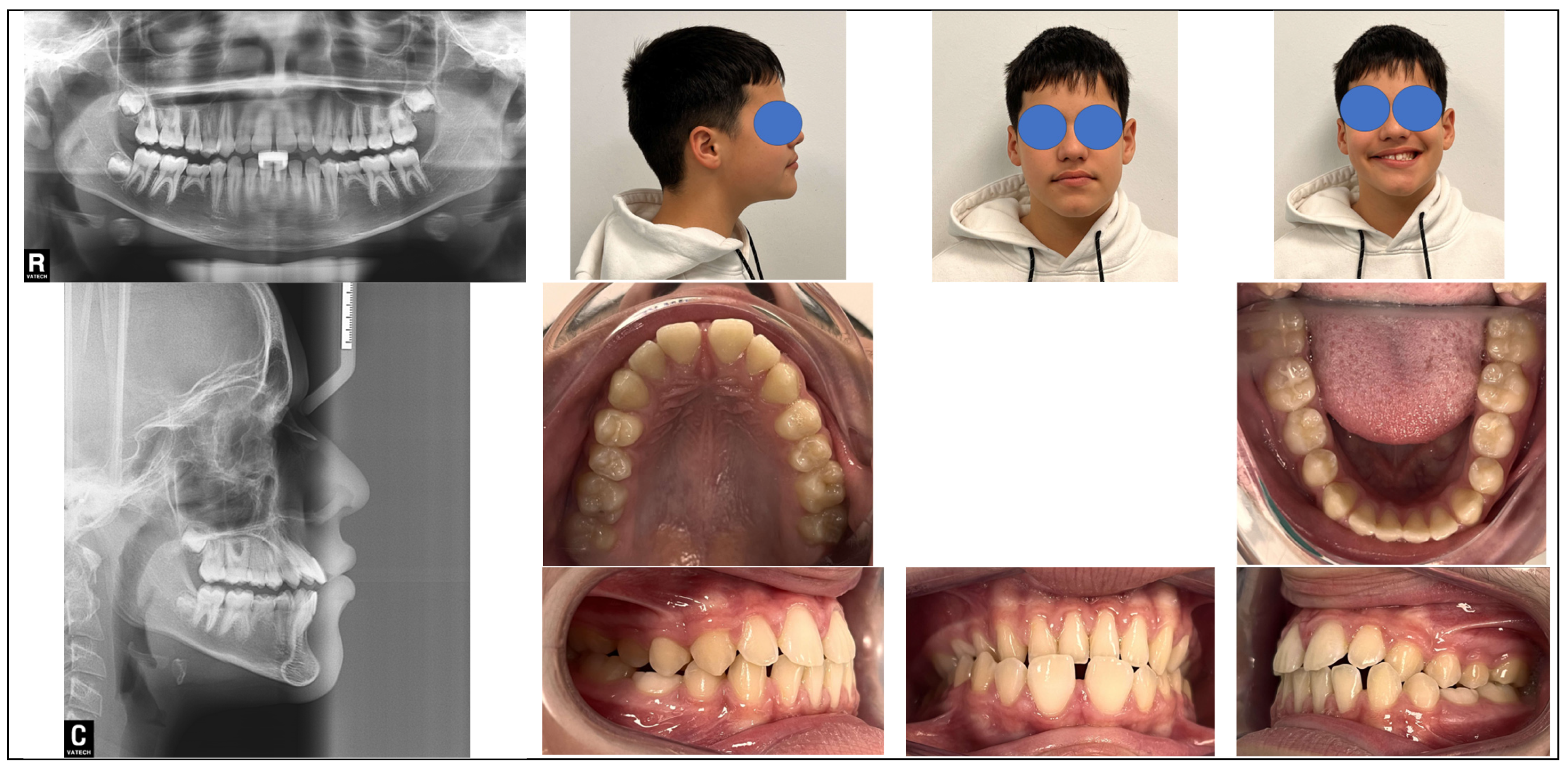 Children 12 01635 g002