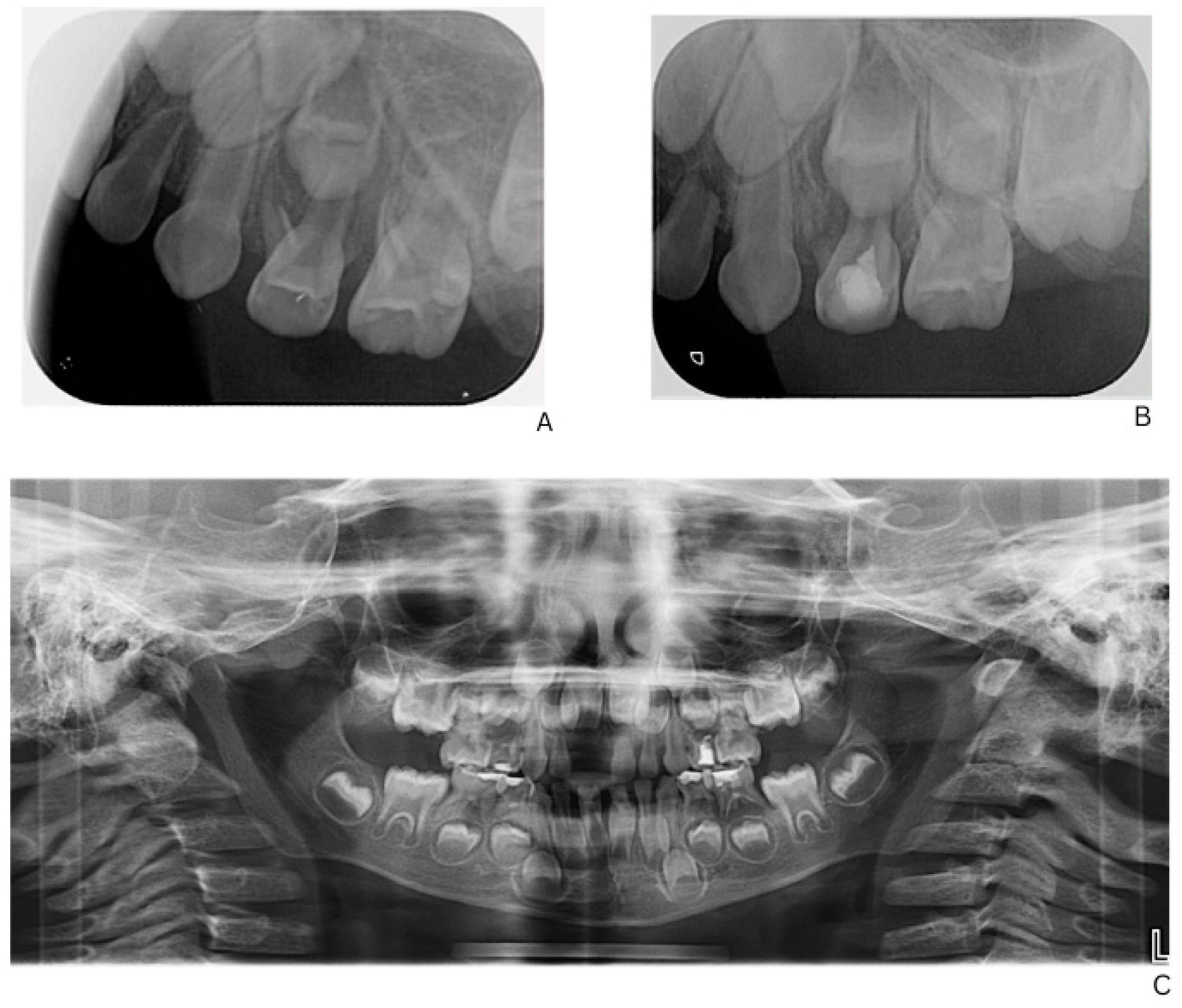 Children 13 00016 g002