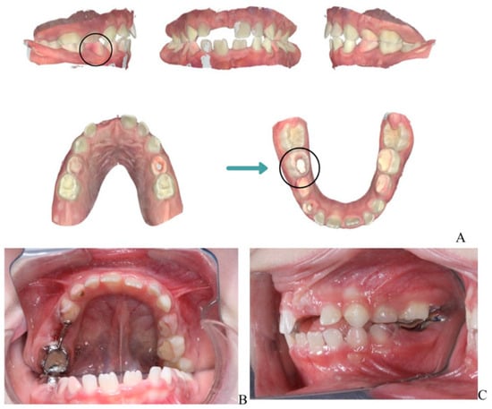 Children 13 00016 g003