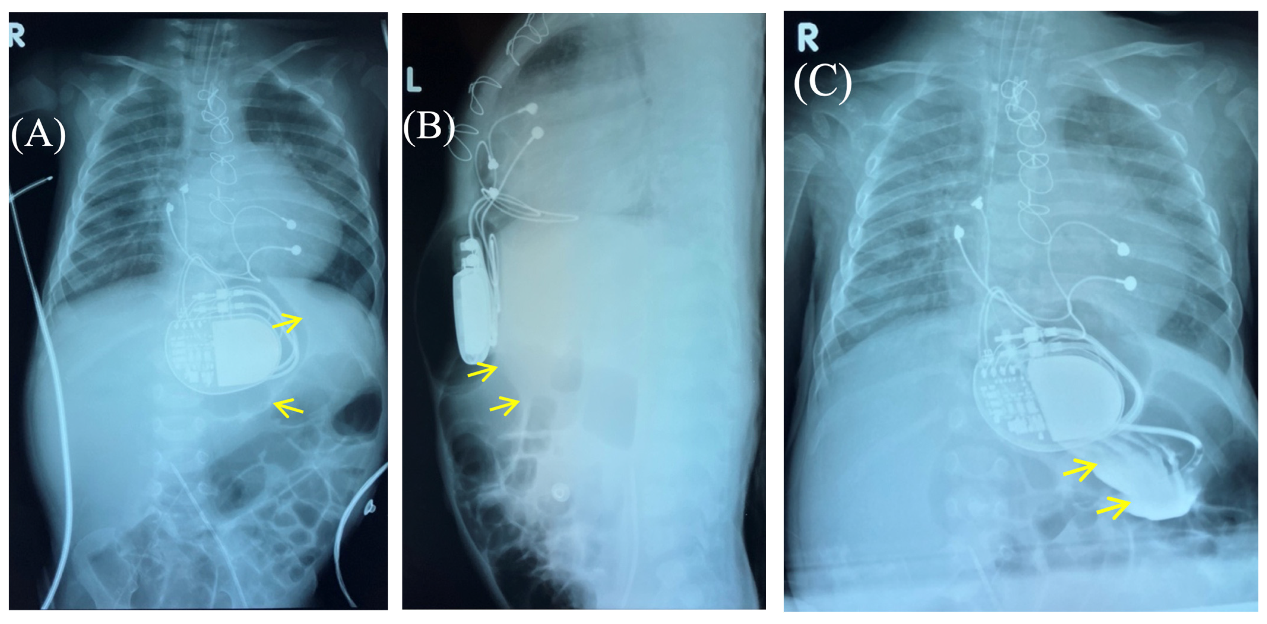 Children 13 00018 g003 Children 13 00018 g003