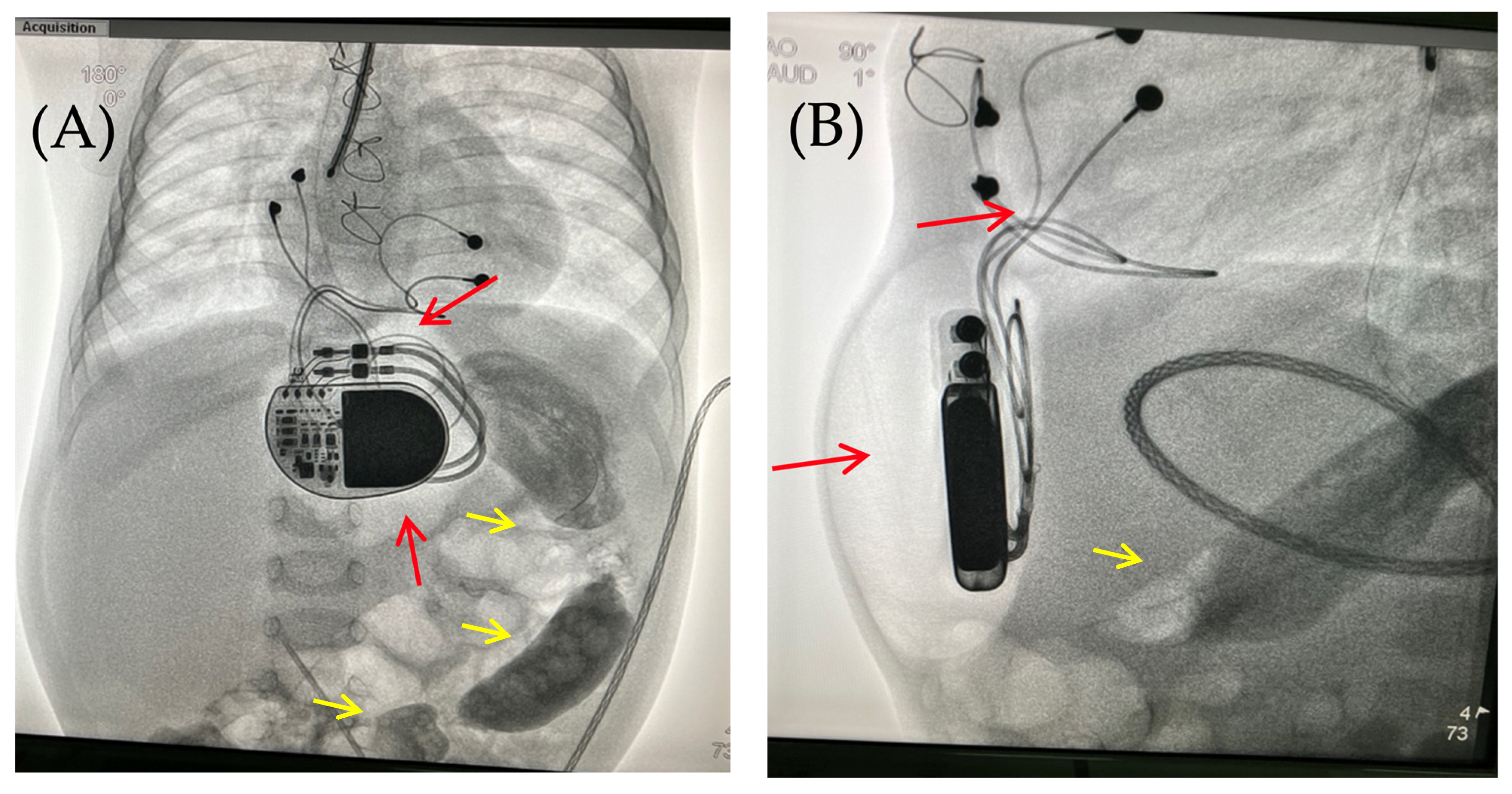 Children 13 00018 g004 Children 13 00018 g004