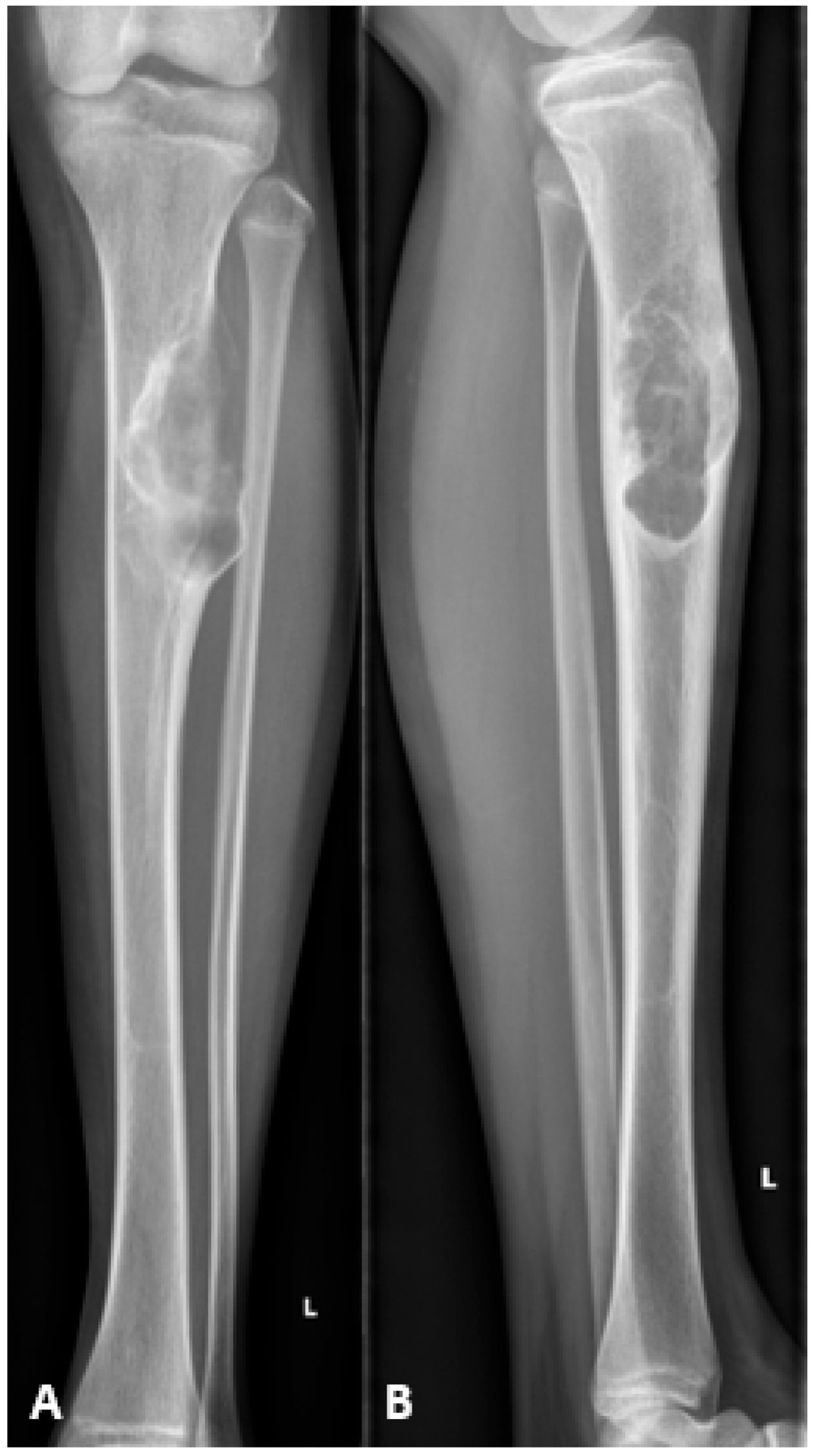 Children 13 00026 g001