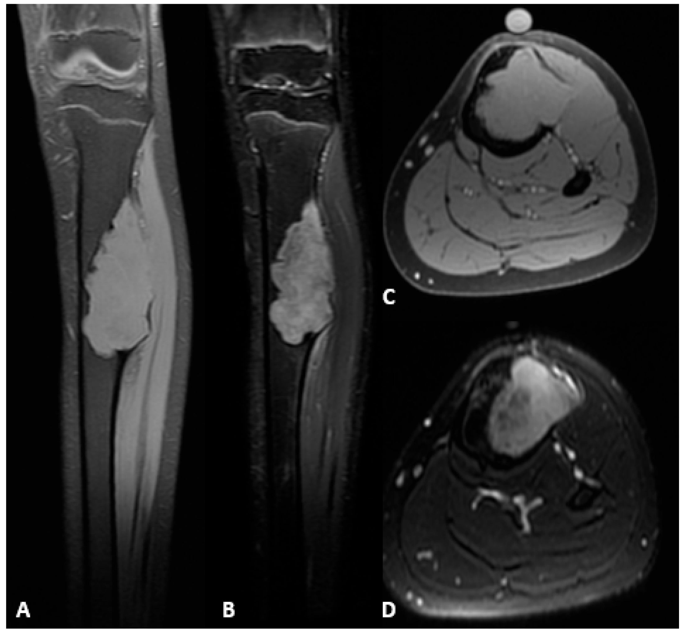 Children 13 00026 g002