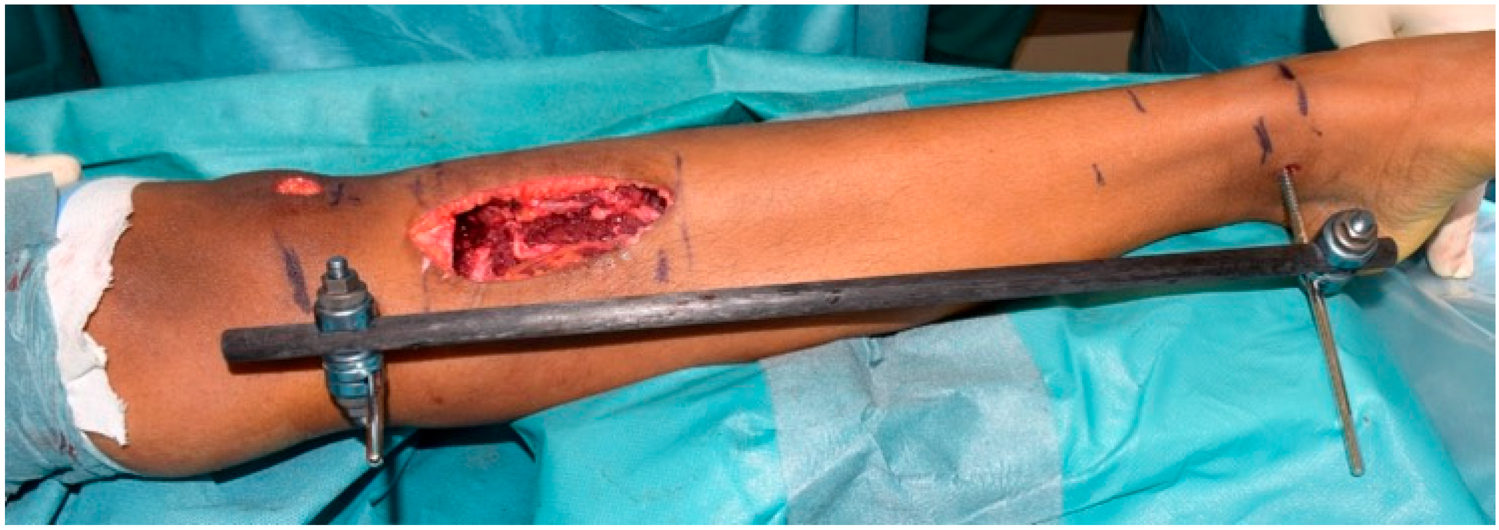 Children 13 00026 g003