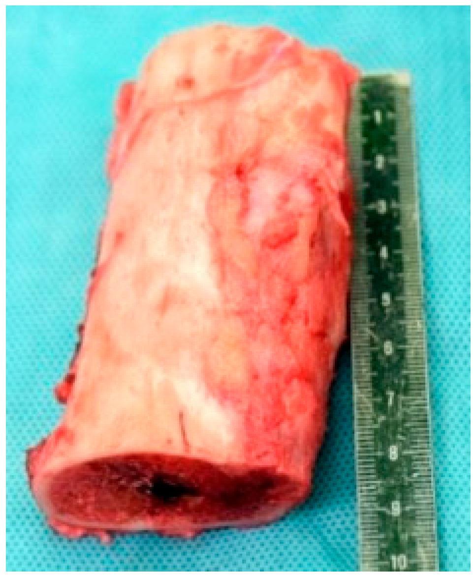 Children 13 00026 g004