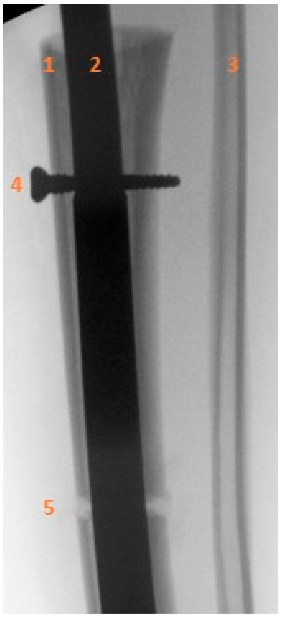 Children 13 00026 g005