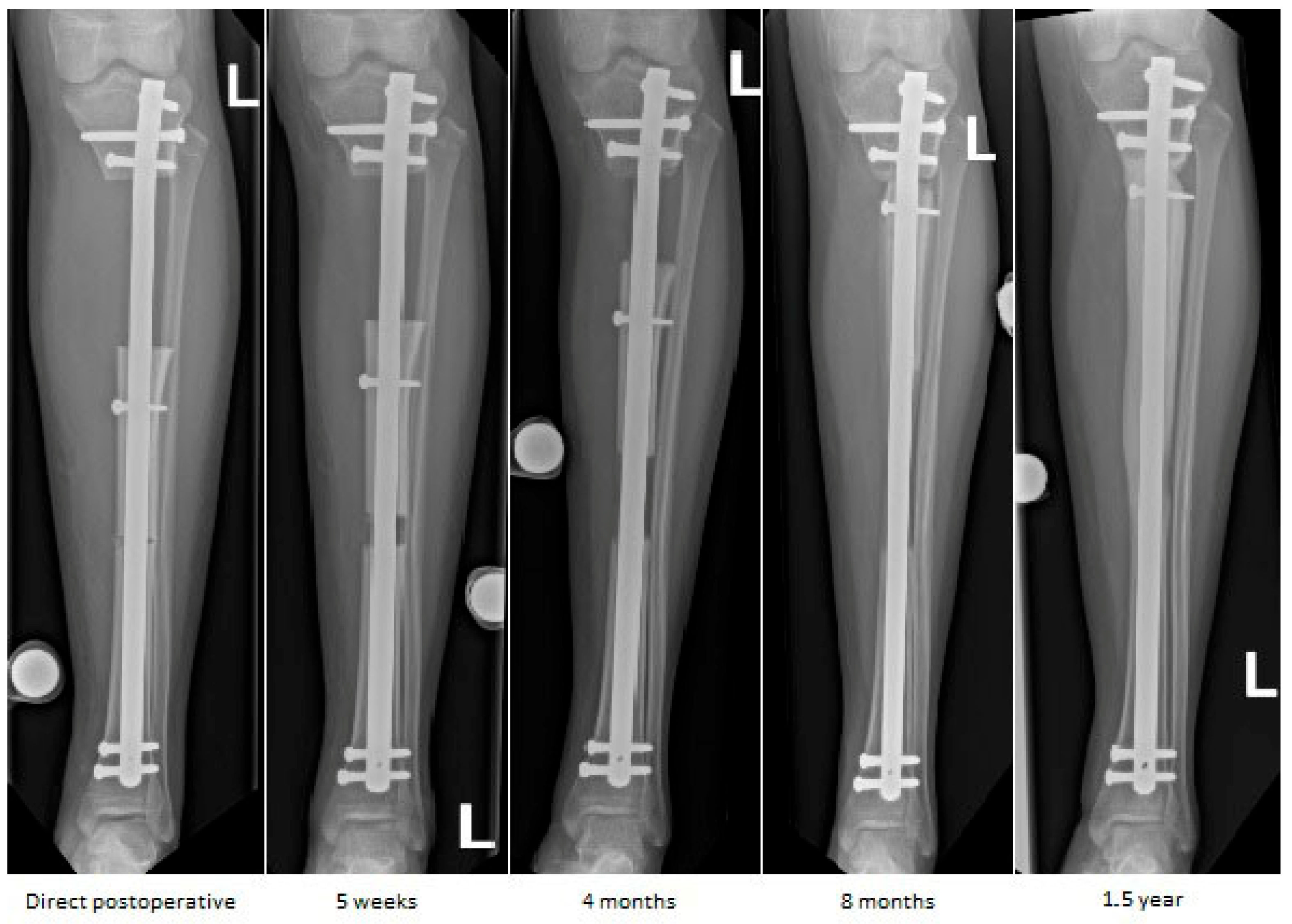 Children 13 00026 g006