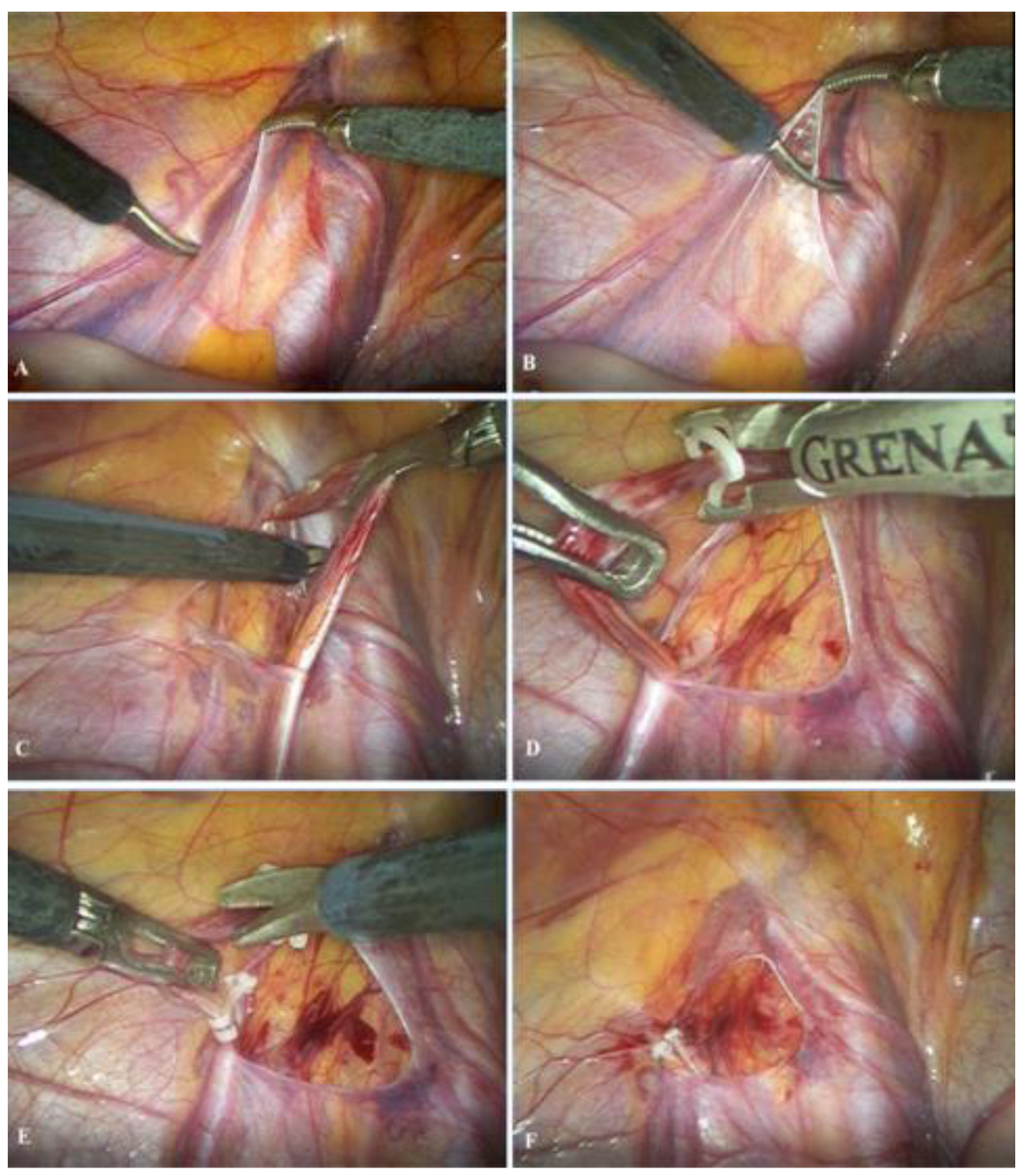 Children 13 00077 g002