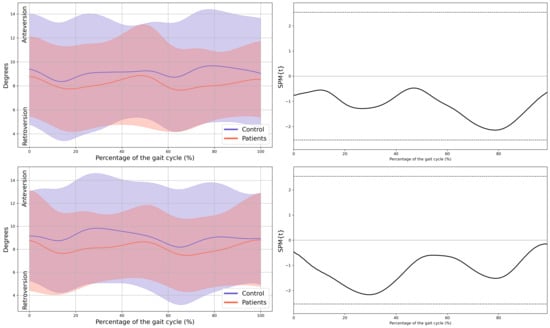 Children 13 00096 g0a1